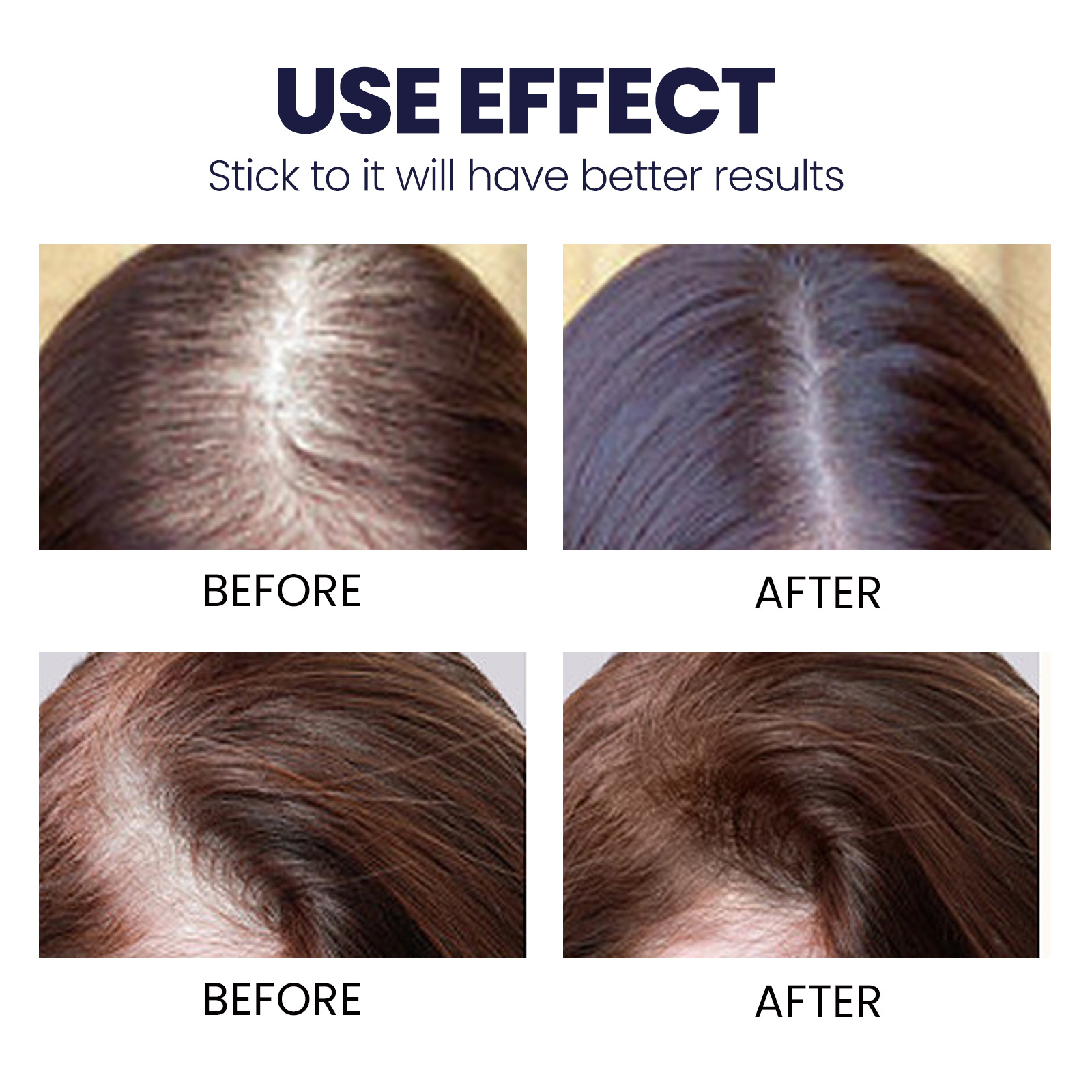 Hair Lotion Serum Essence Oil Hair Applicator Hair Growth Treatment Hair Anti Hair Loss Spray Stripping and Repairing Damaged Hair Roots for Men Women