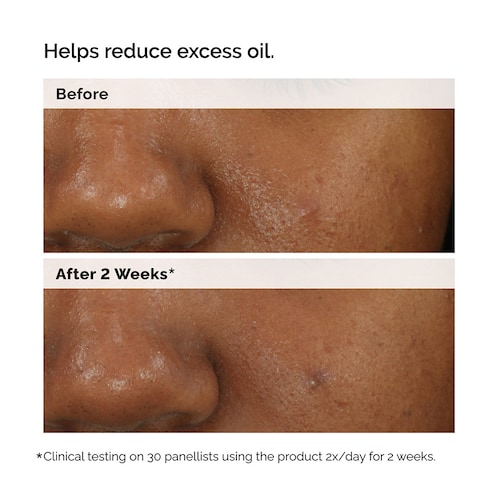The Ordinary Balancing Clarifying Serum for Blemish Prone Skin 30ml