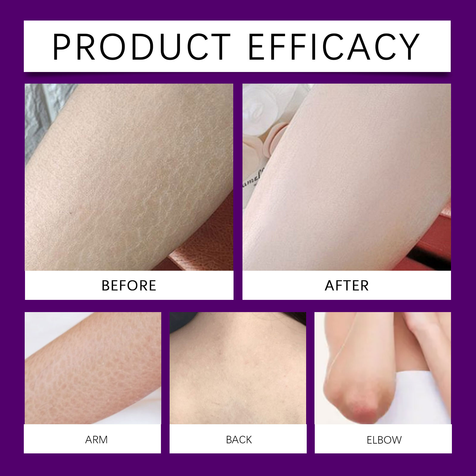 Skin Care Cream Elastic Moist Light Smooth Delicate Bright Hydrating Refreshing Non Greasy Body Daily Maintenance