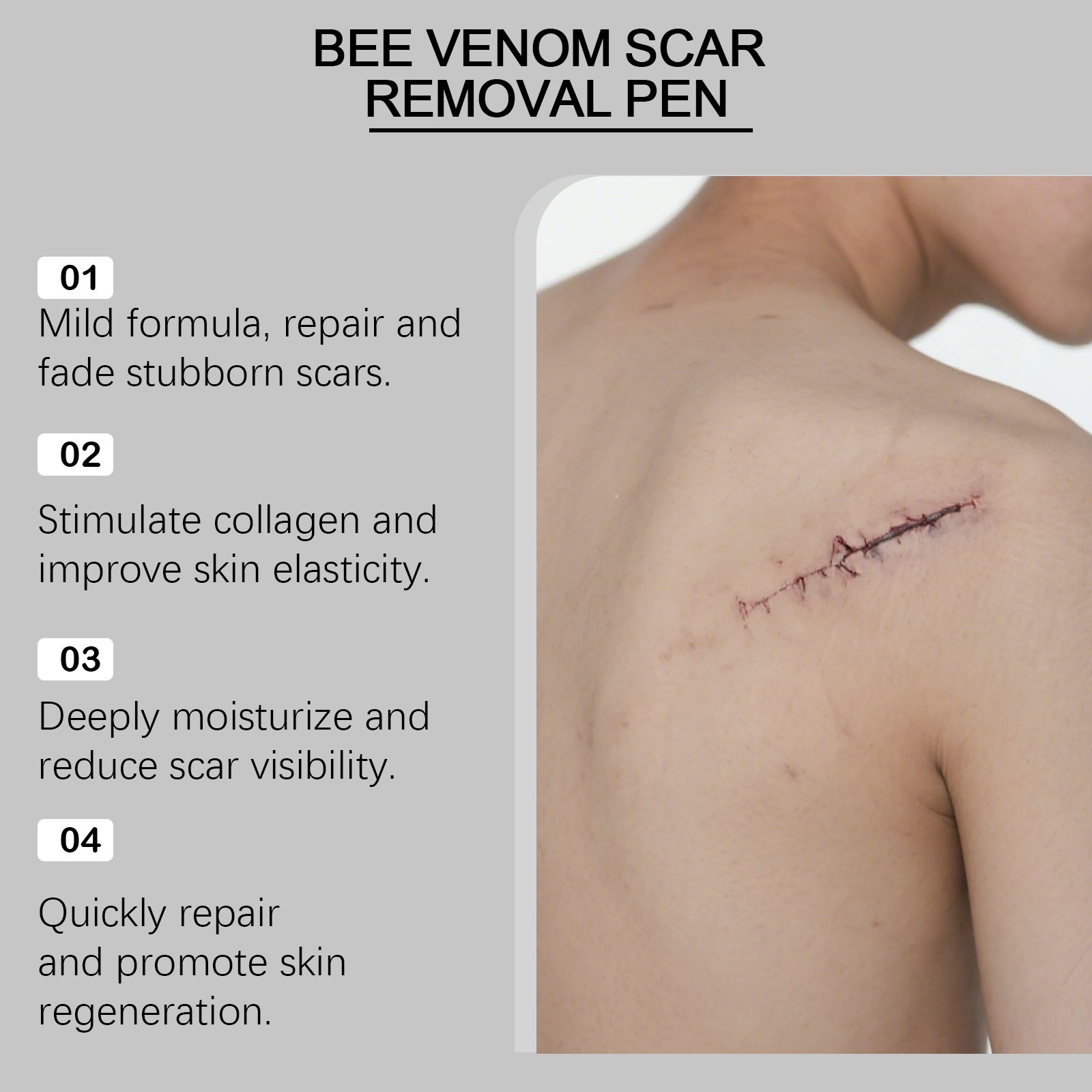 Bee Venum Skin Scar Care Pen Mild Moisturizing Body Skin Scar Smoothing Tender Daily Care Pen