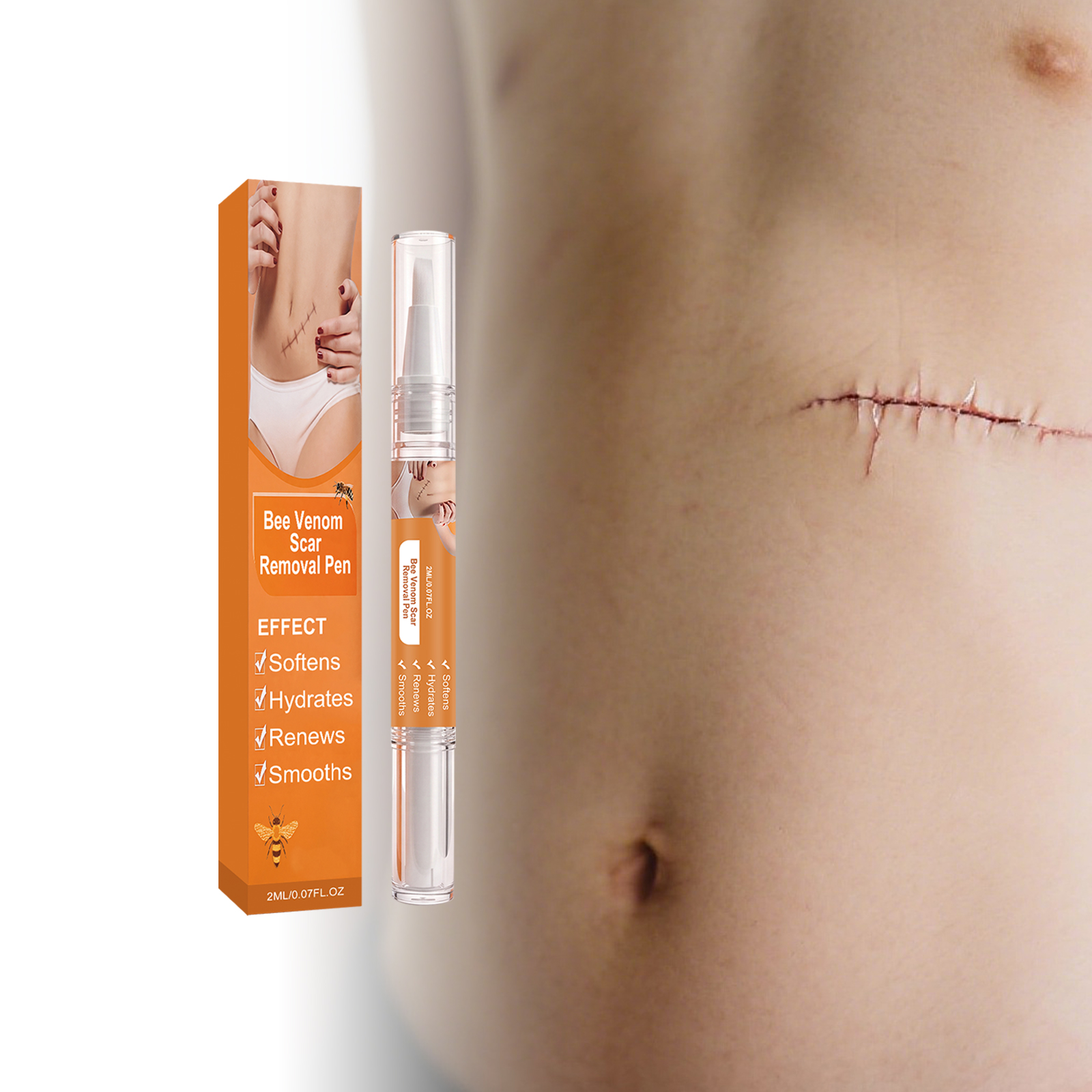 Bee Venum Skin Scar Care Pen Mild Moisturizing Body Skin Scar Smoothing Tender Daily Care Pen