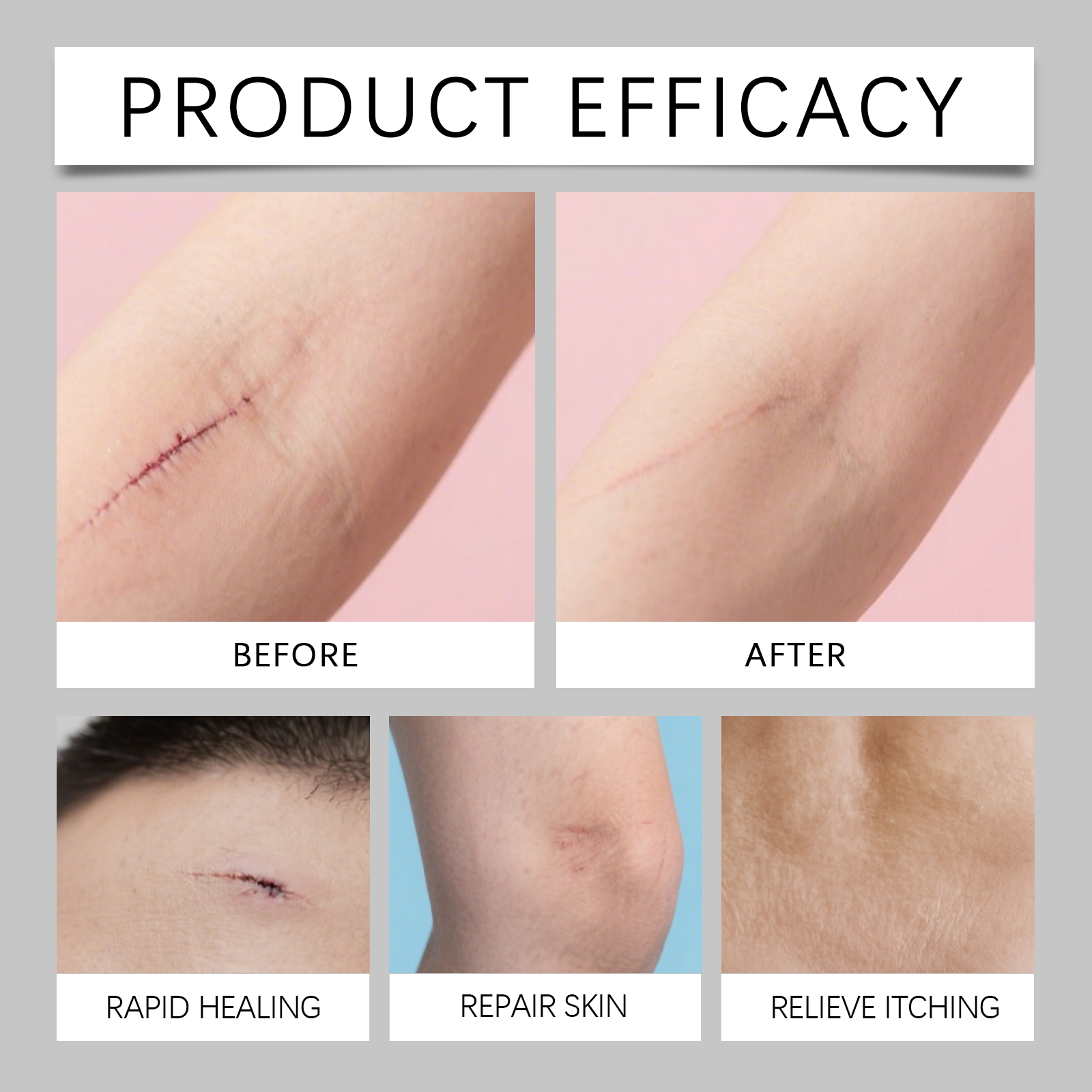 Bee Venum Skin Scar Care Pen Mild Moisturizing Body Skin Scar Smoothing Tender Daily Care Pen