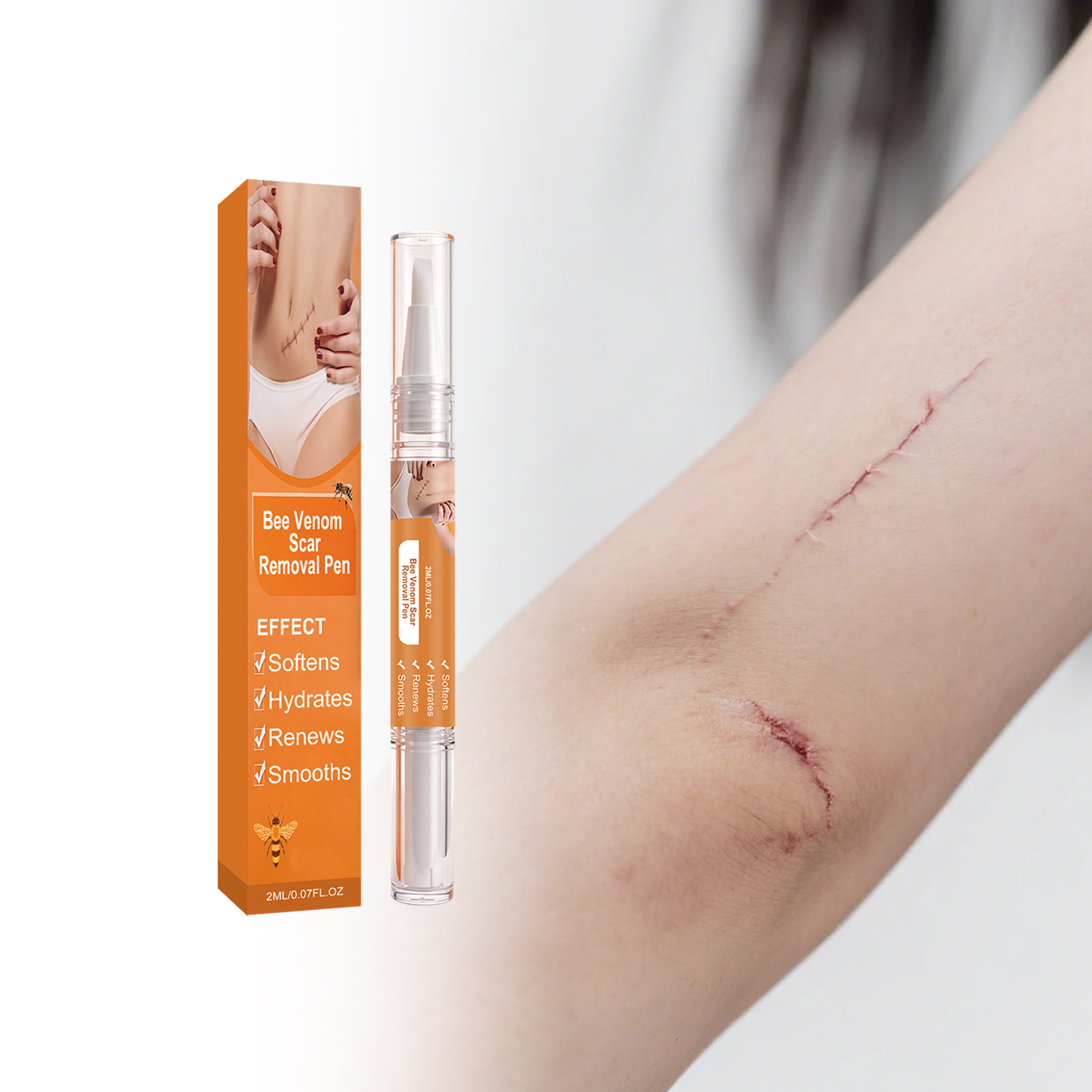 Bee Venum Skin Scar Care Pen Mild Moisturizing Body Skin Scar Smoothing Tender Daily Care Pen