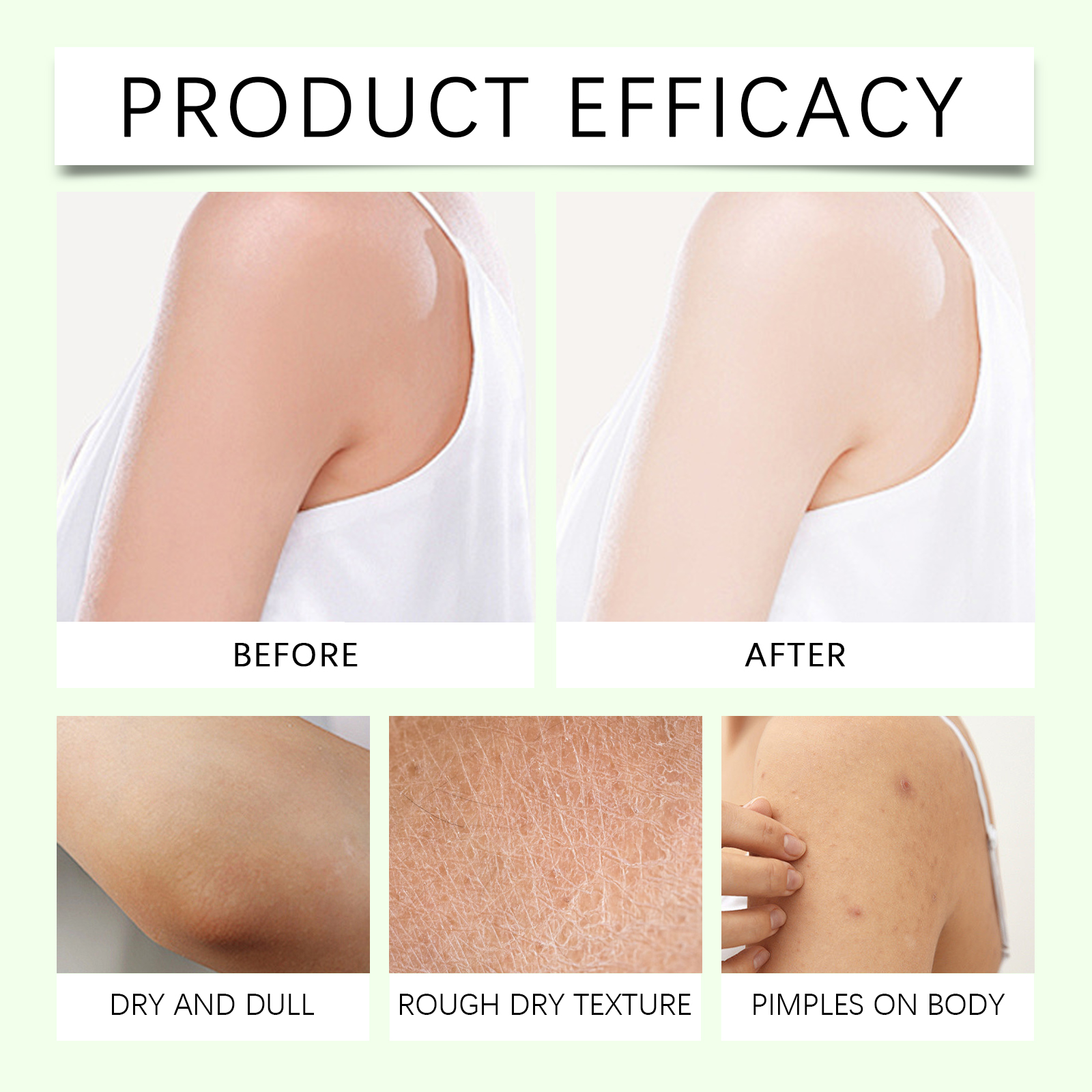 Shea Butter Body Lotion Mild Gentle Moisturizing Smoothing Skin Care For Body Skin