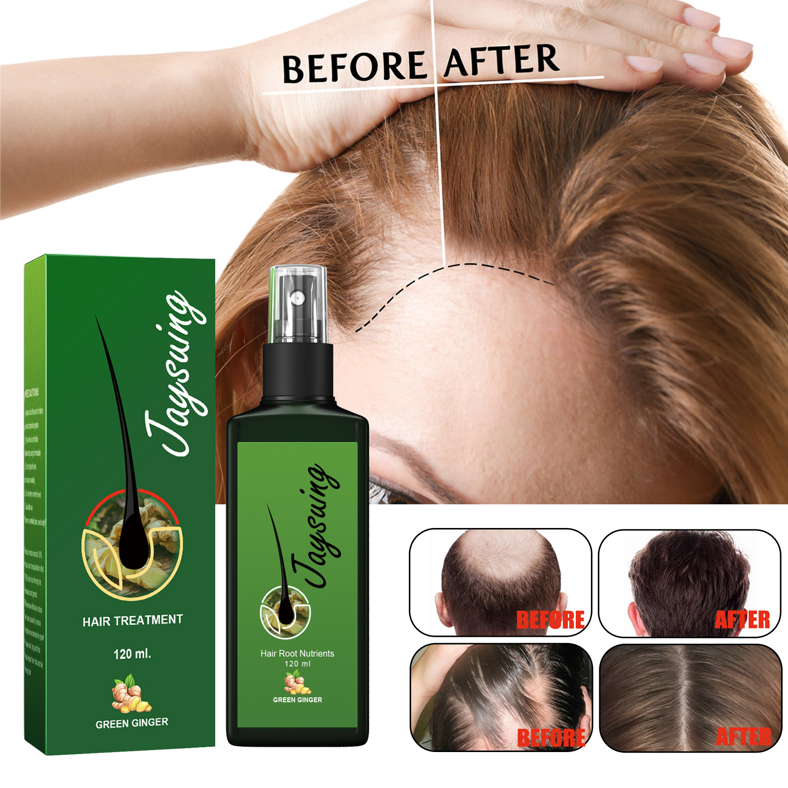 (30ml) Hair Growth Serum Hair Lotion Ginger Serum Hair Spray Anti Loss Promotes Thicker Natural Nourishing Hair Care for Men Women