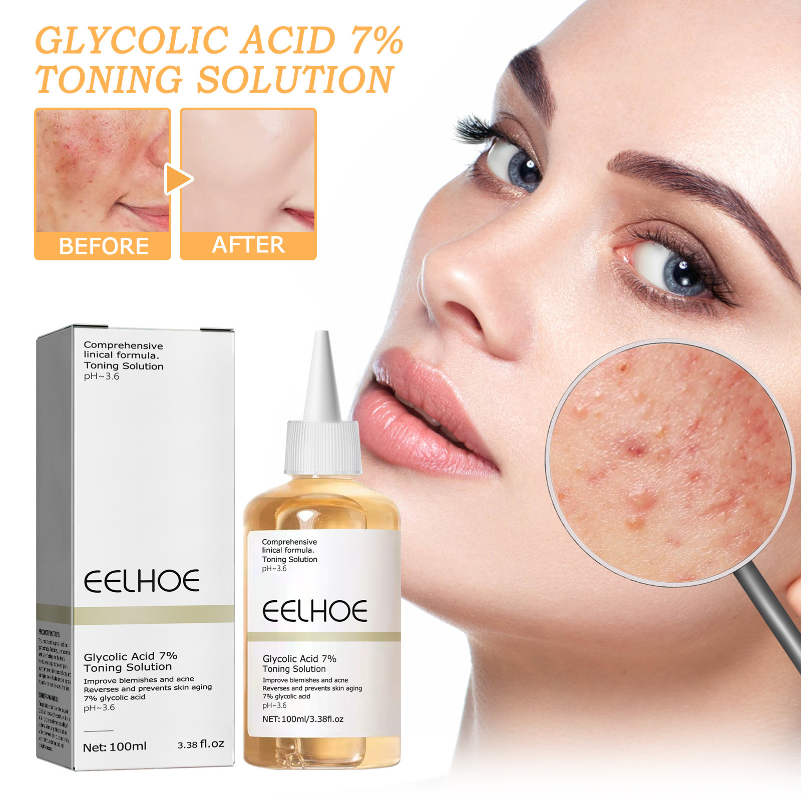 Face Toner for Women Glycolic Acid 7 Percent Toning Resurfacing Solution Improve Blemishes Remove Acne Marks Skin Care