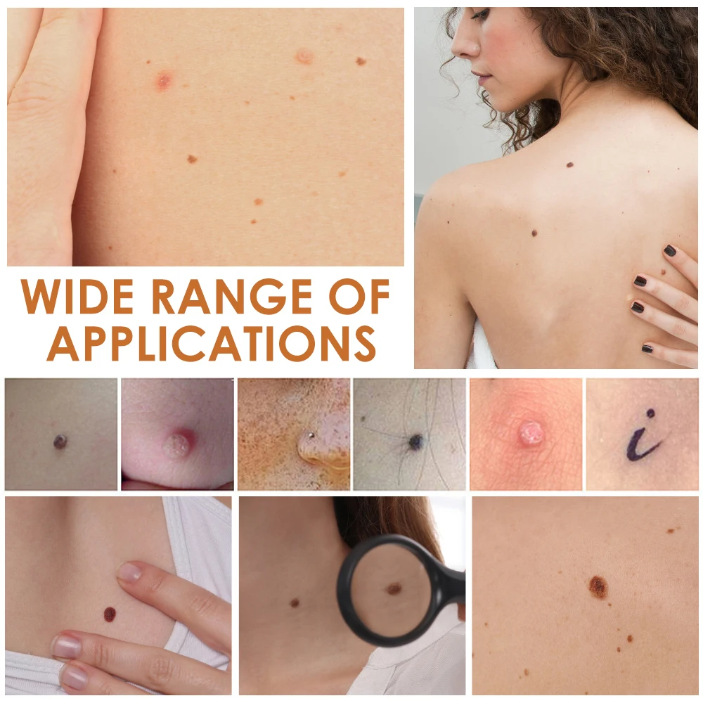 Freckle Dark Spot Mole Pen Blue Light Ionized Carbonization Repair Electric Salon Special Remove Skin Tag Fat Grain Warts Berrugas Eliminator Plasma Pen