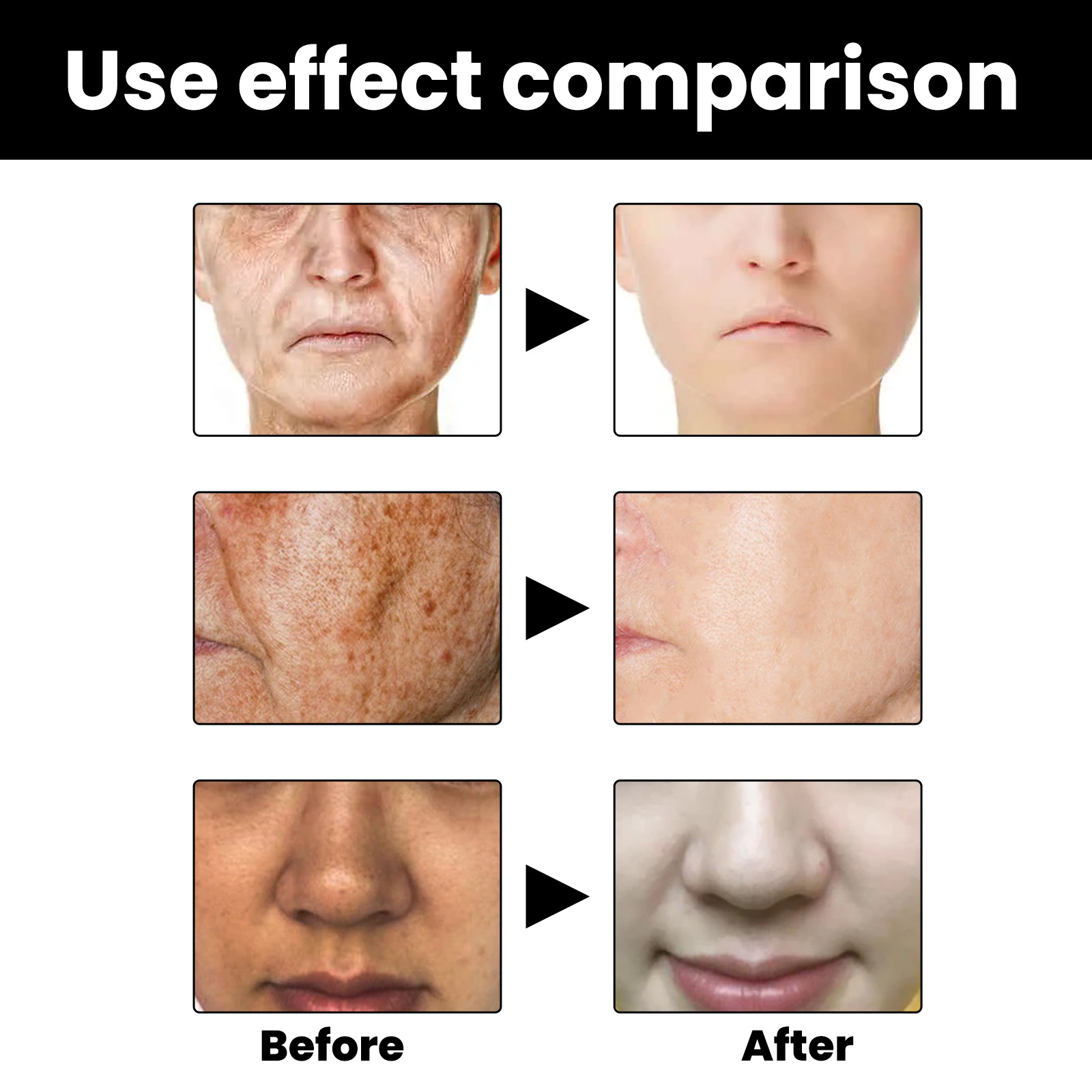 EELHOE Skin Melanin Correcting Serum Fade Dark Spots Anti Freckle Melasma Remover Dull Skin Nourish Lighten Pigment Blemish Glow Vitamin C Face Essence.