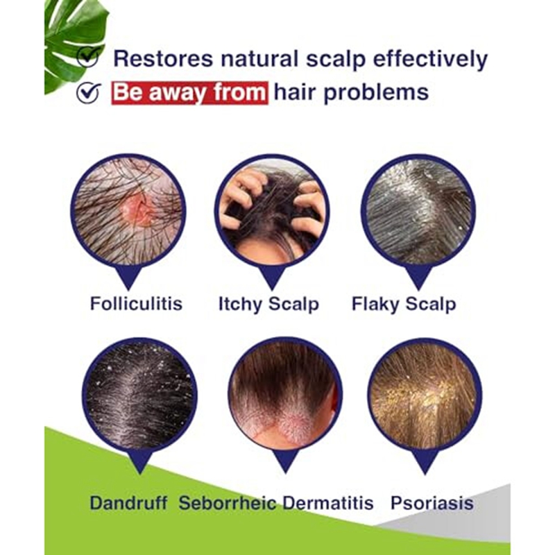 Folliculitis Shampoo, Seborrheic Dermatitis Shampoo, Anti Dandruff Shampoo, Antifungal Shampoo, Folliculitis Treatment,
