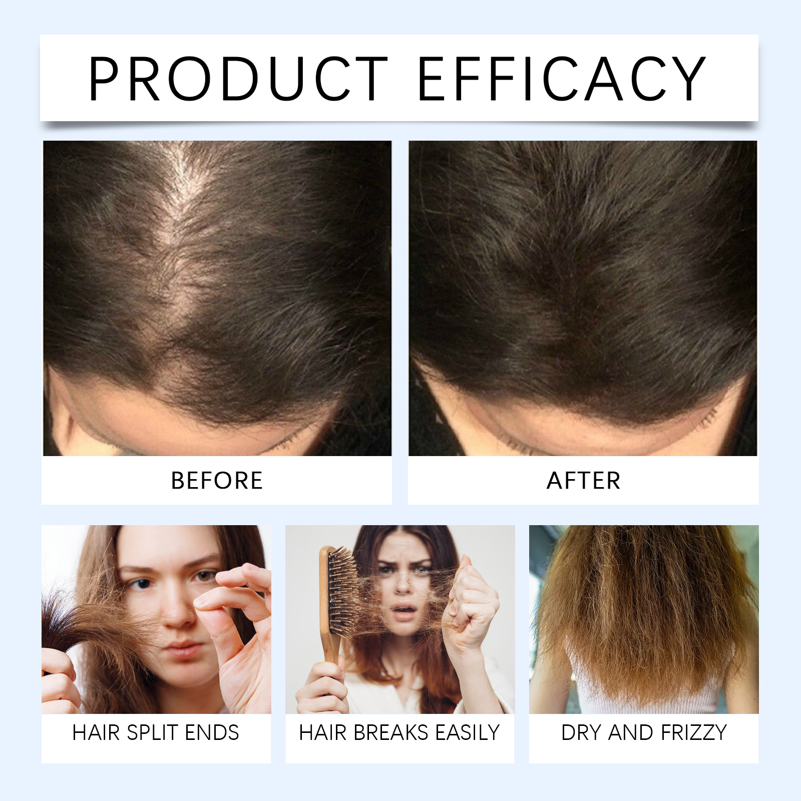 Hair Roller Essence Mild Nourish Soft Care Scalp Massage Daily Oil