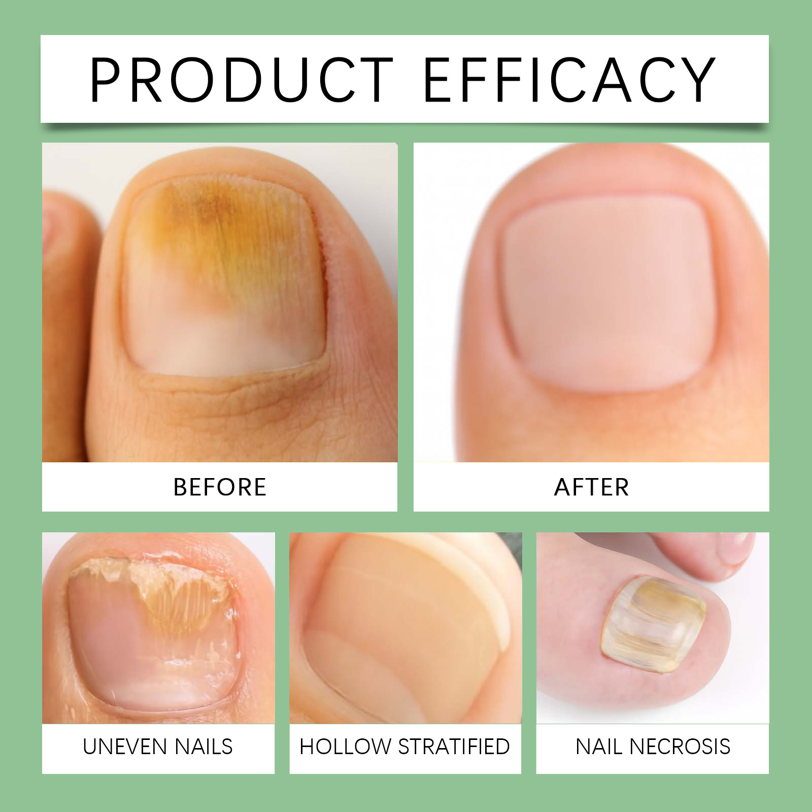 Nail Care Lotion Moisturizing Strengthening Glossy Gentle Exfoliating Fingertip Repair Essence