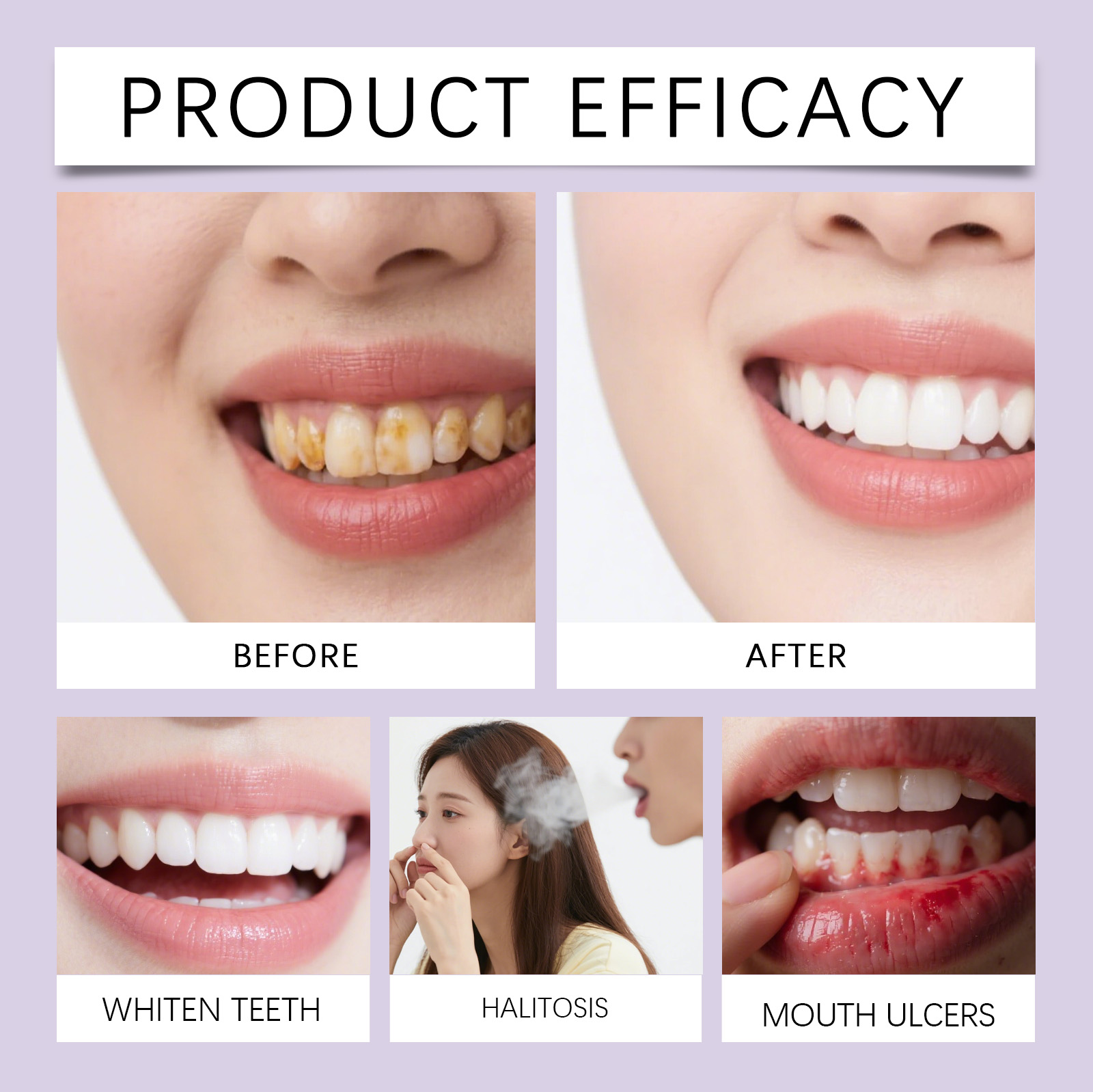 Purple Brightening Stain‑removing Teeth Strips Gentle Ingredients Nourish Teeth Clean Glossy Fresh Oral Convenient Dental Care