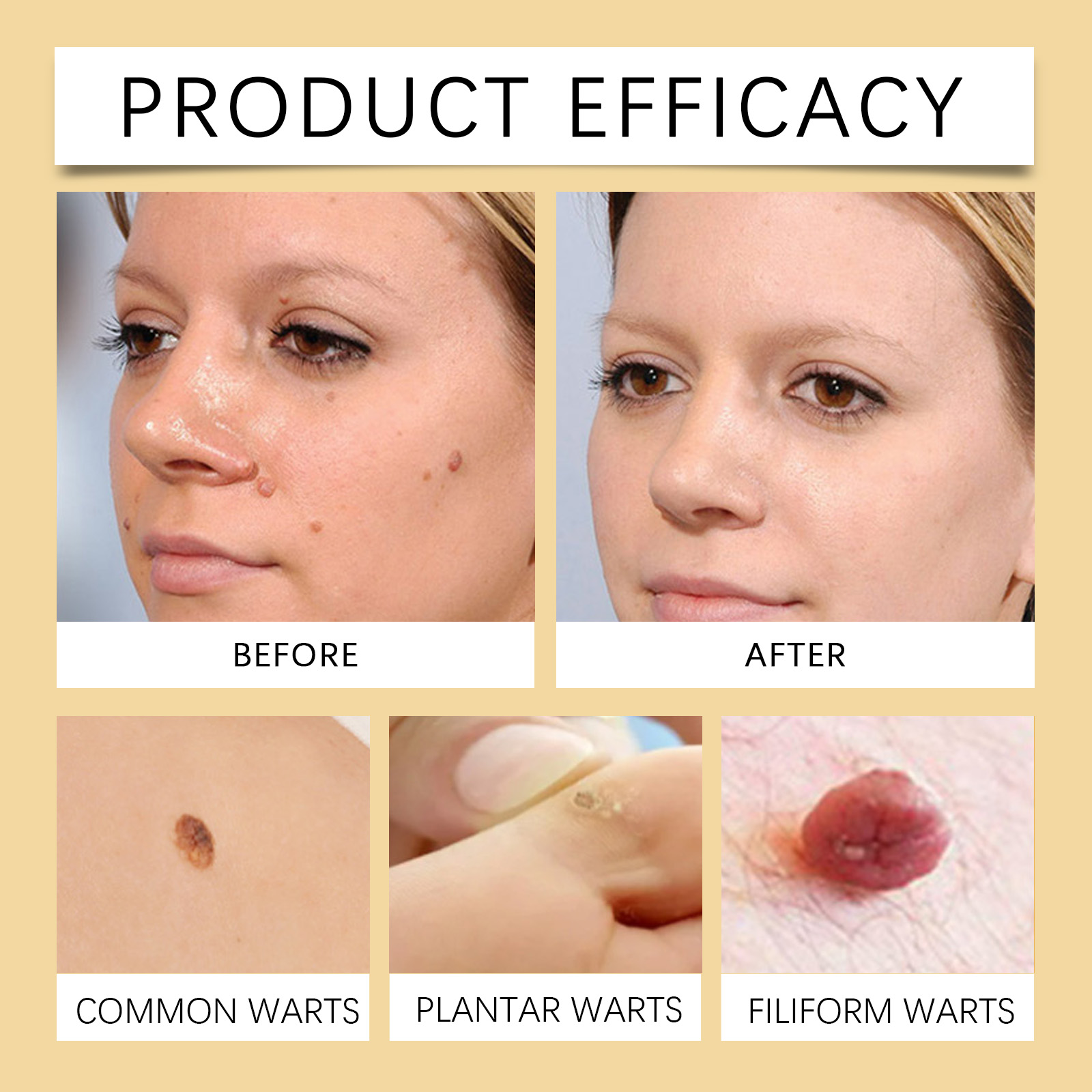 Bee Venom Keyou Ointment Mild Cleansing Smooth Moisturizing Bee Venom Extract For Body Skin