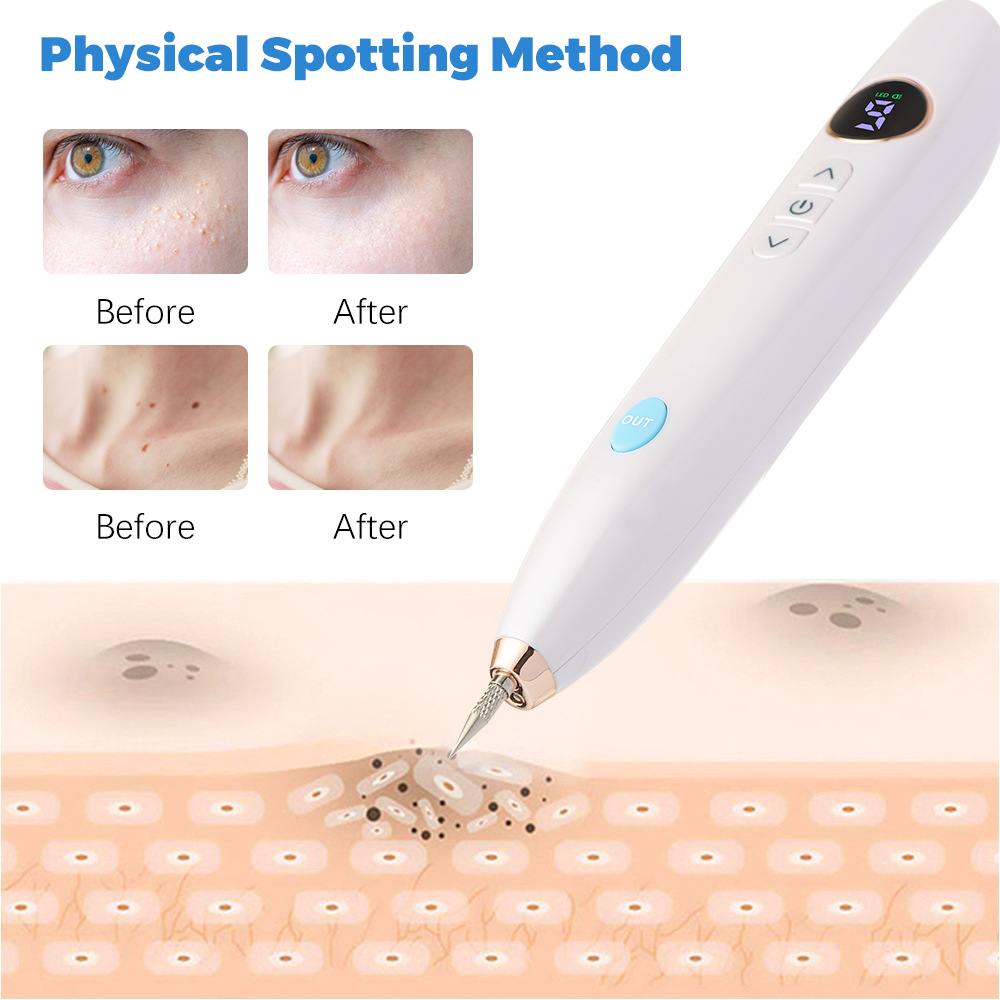Laser Plasma Pen Mole Removal Dark Spot Skin Tag Tattoo Mole Wart Remover Pen