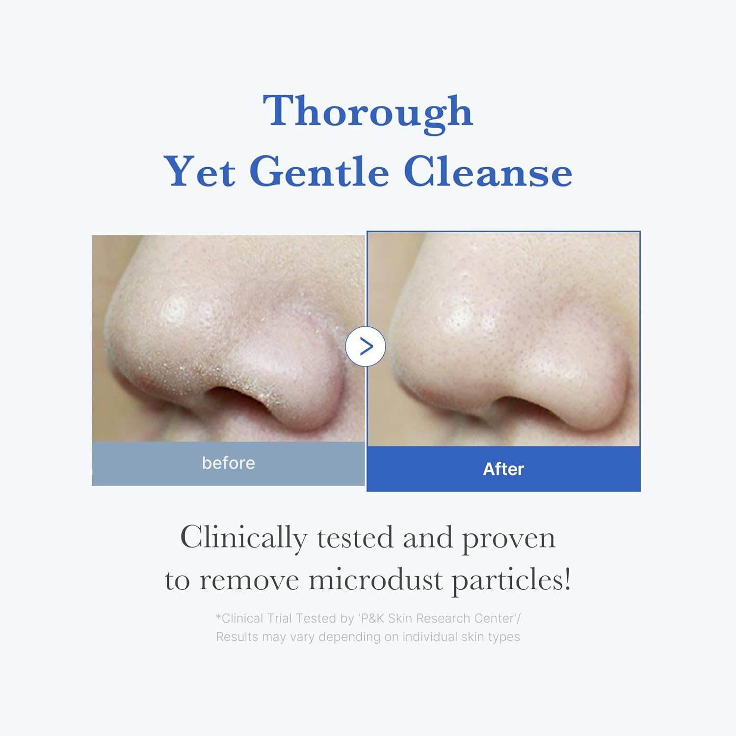 medicube Zero Foam Cleanser for Sensitive Skin Sebum Control Moisture Balance and Pore Minimization Korean Skincare Skin Healthy and Glowing Routine 120g