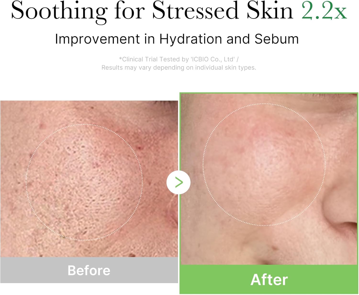 medicube Exosome Cica Tea Tree Cream for Sensitive Skin Centella Asiatica help reduce redness breakouts Moisturising Daily Texture Care Korean Skincare 50ml