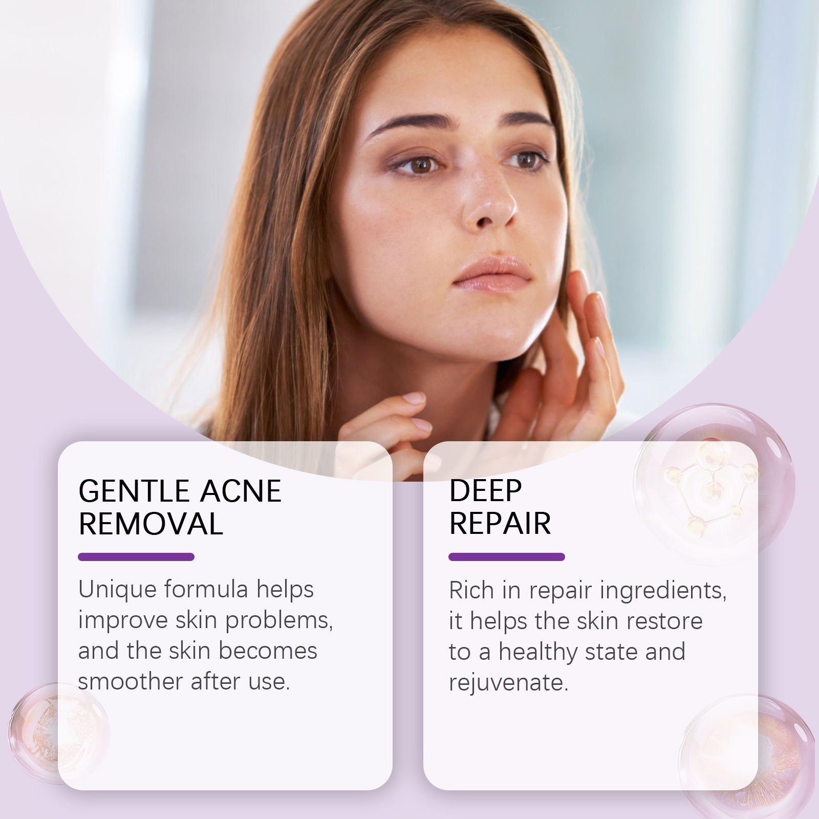 Azelaic Acid Blemish Care Cream For Gentle Moisturizing And Soothing Acne Prone Skin 