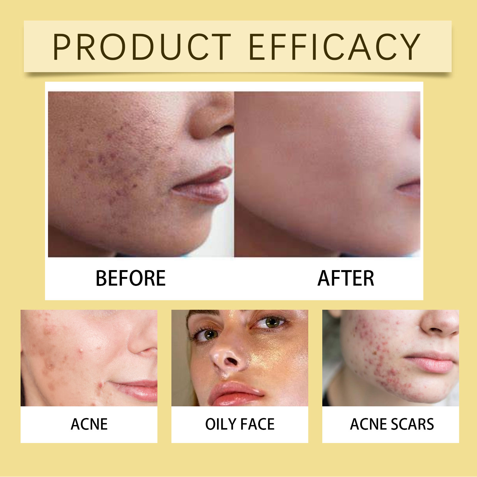 Facial Essence Set Mild Hydrating Moisturizing Soft Delicate Bright Care Daily Skin Care Liquid