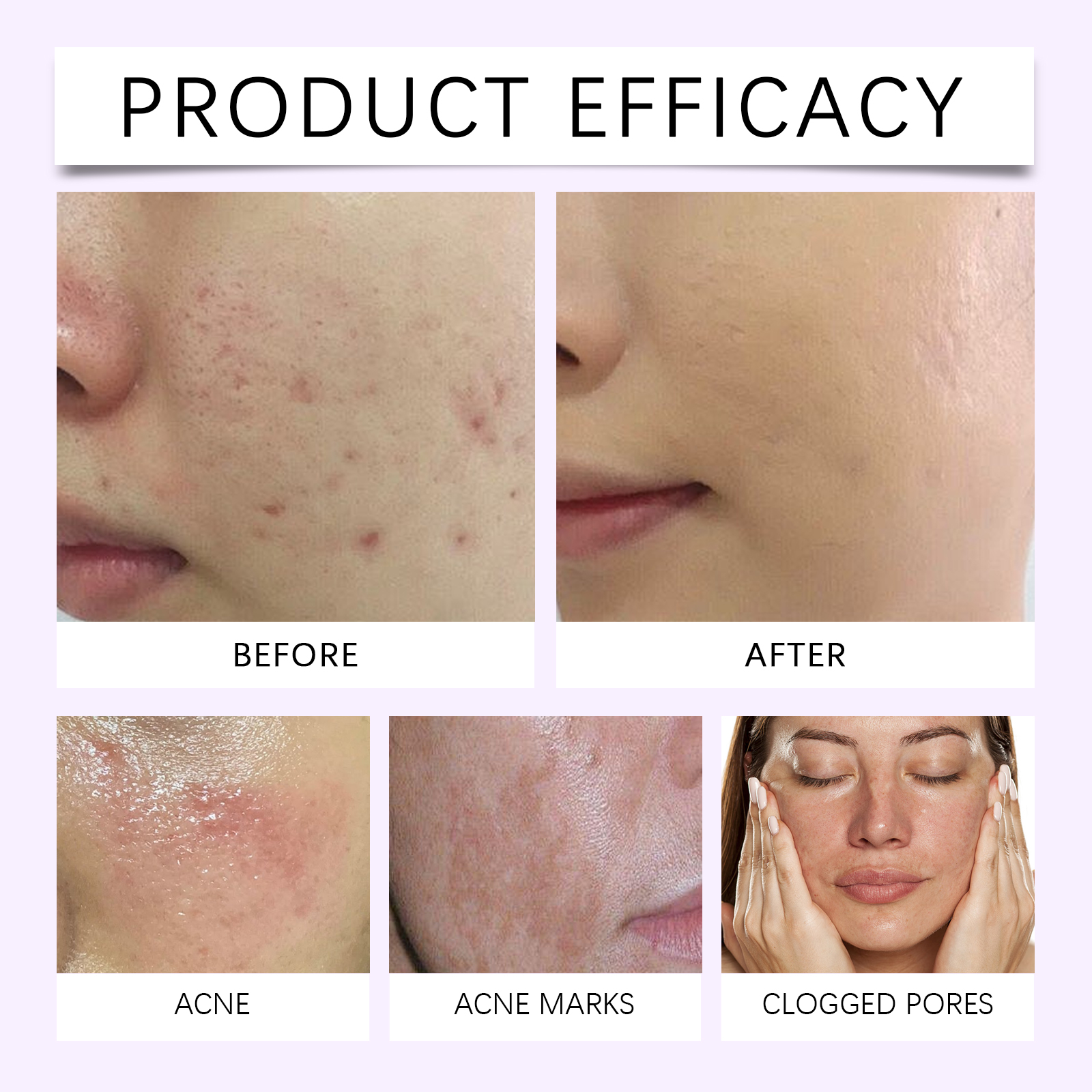 Skin Moisturizing Essence Liquid Delicate Care Facial Skin Light Texture Refreshing Hydrating Skincare Extract