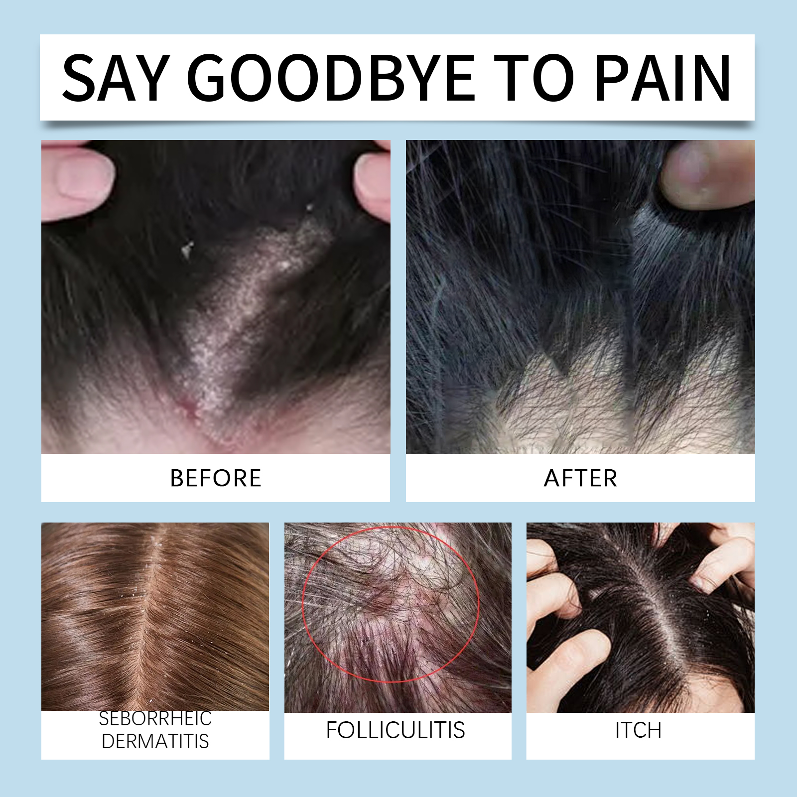 Scalp Soothing Cream Mild Nourishing Cleansing Repair Improve Massage Scalp Reduce Dandruff Care