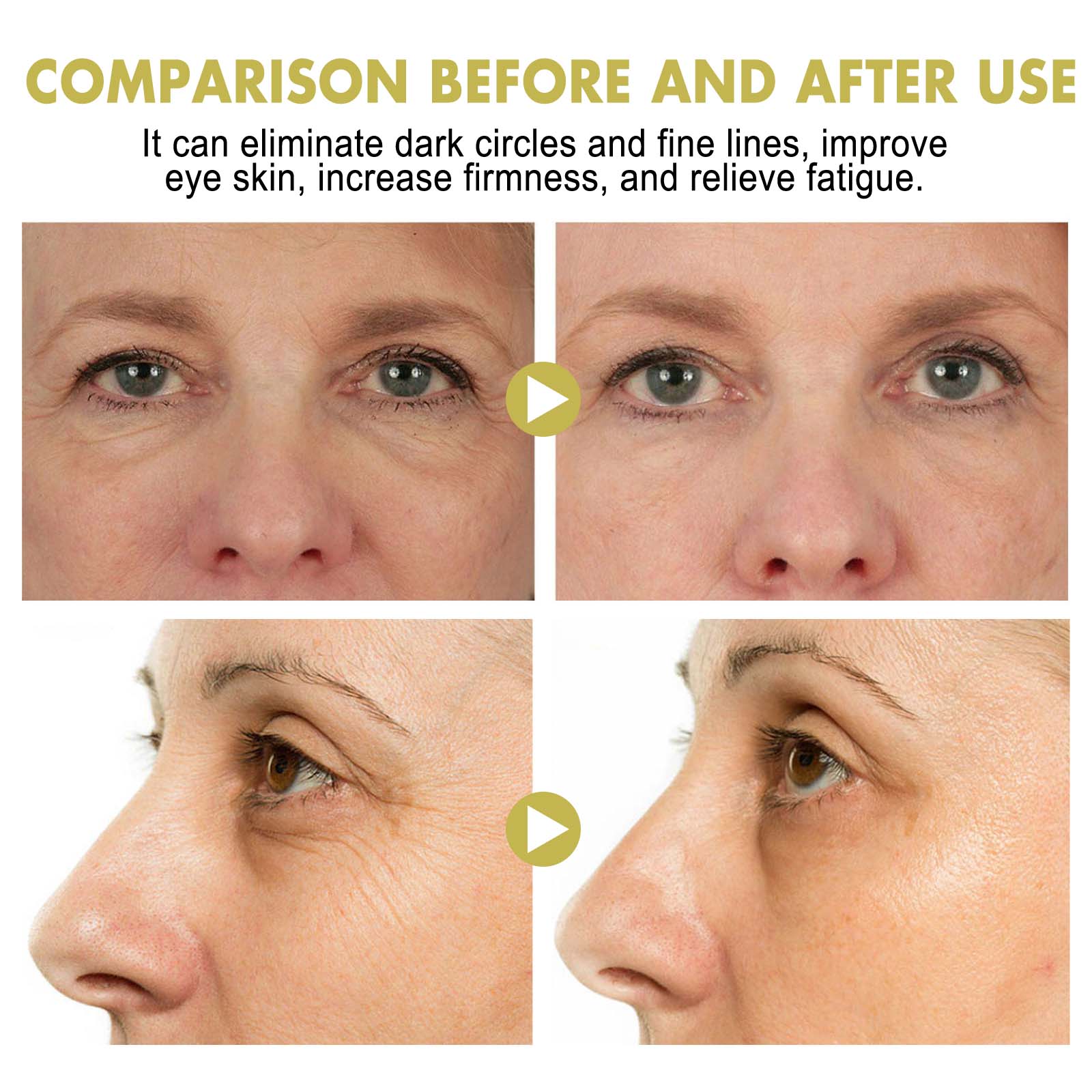 Snail Eye Cream Stick Moisturizing Firming For Dark Circles Puffiness And Fine Lines Daily Eye Care