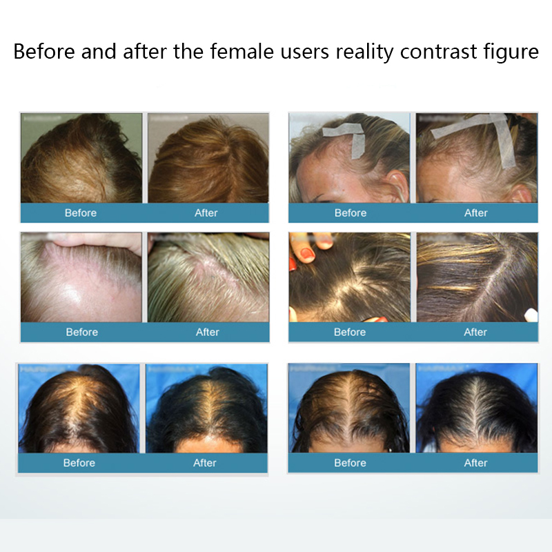 Laser Hair Growth Comb Infrared Therapy Treatment Vibration Massage Anti Hair Loss For Hair Tonic Liquid Massage Comb