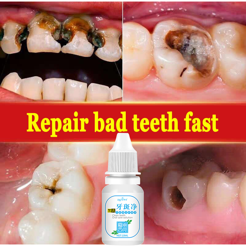 Clean Teeth Oral Care Solution Whiten Teeth Remove Plaque Stains Fresh Breath Oral Hygiene Dental Tools