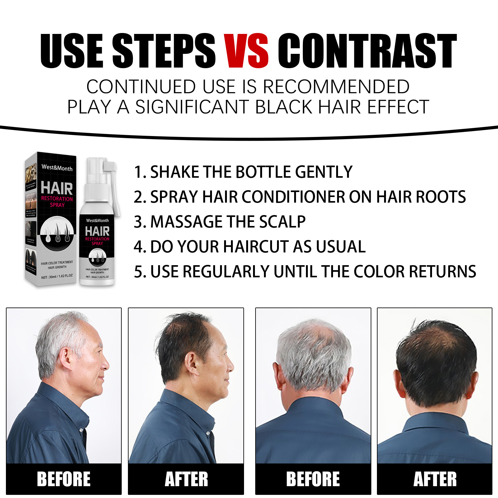 Hair Restoration Spray Black Hair Spray Non-greasy Moisturizing Effective Anti-Hair Loss 30ml