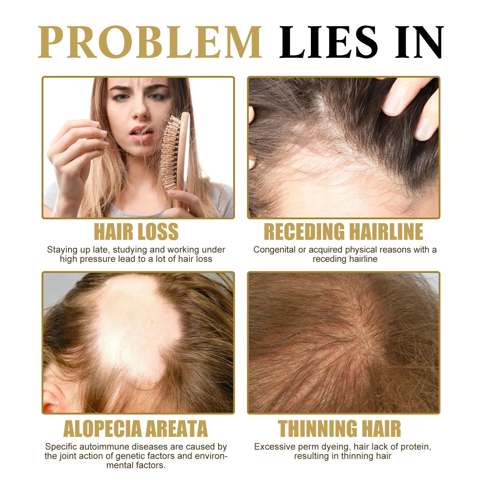 Anti Hair Loss Fast Essence Strengthens Hair Roots Repair Hereditary Postpartum Seborrheic Hair Loss Renewal Serum 20ml
