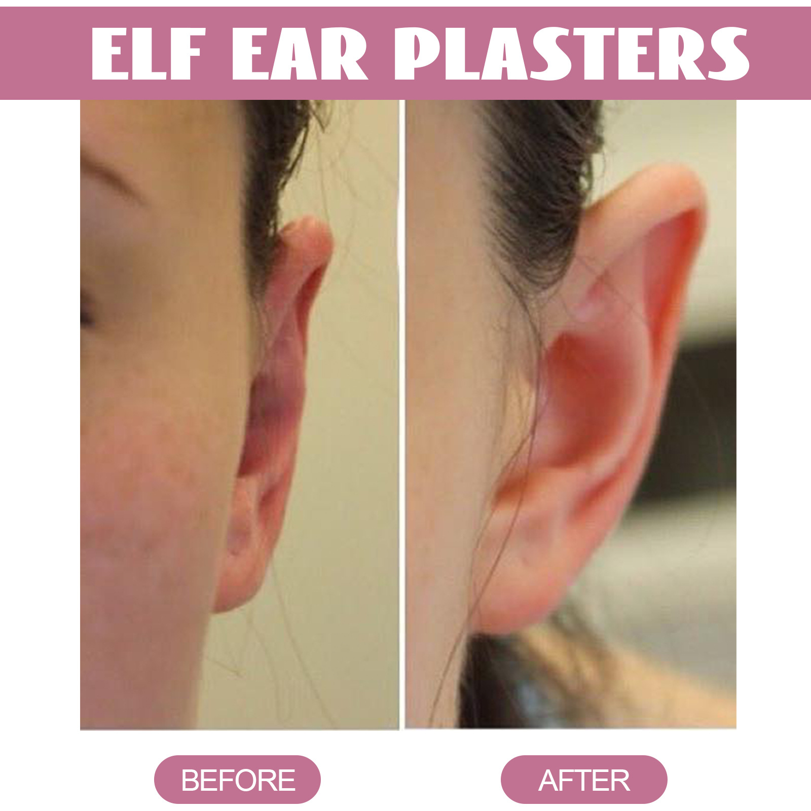 Elf Ear Plasters Cosmetic Protruding Ear Stickers Invisible Protruding Ears Correctar Tap Women Solution Big Ear Supporters Aesthetic Corrector Tools