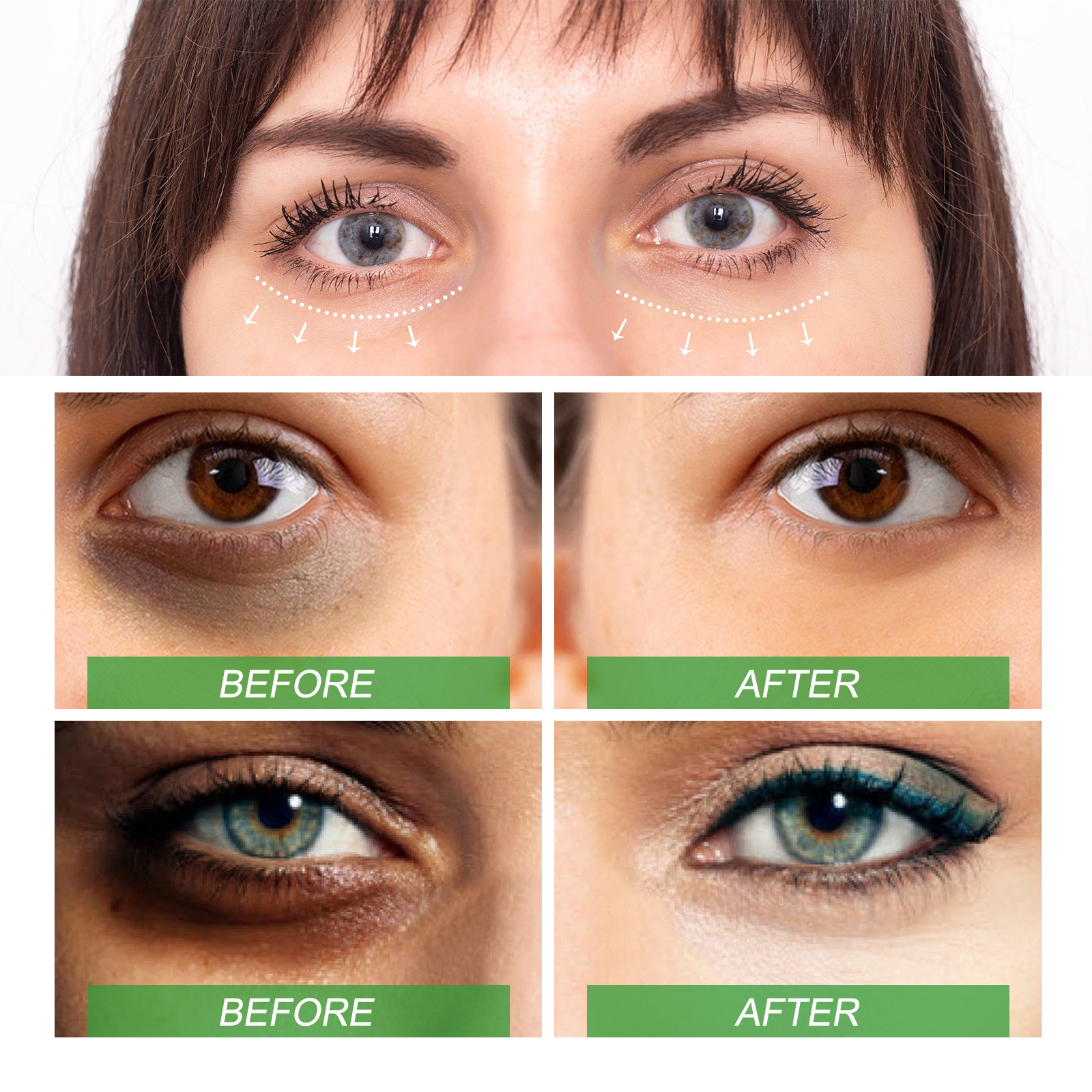 (1 PC) Anti Dark Circle Eye Serum Pigment Correction Remove Puffiness Eyes Bag Fades Fine Lines Moisturize Hydrating Nourish Aloe Vera Whitening Eye Essence