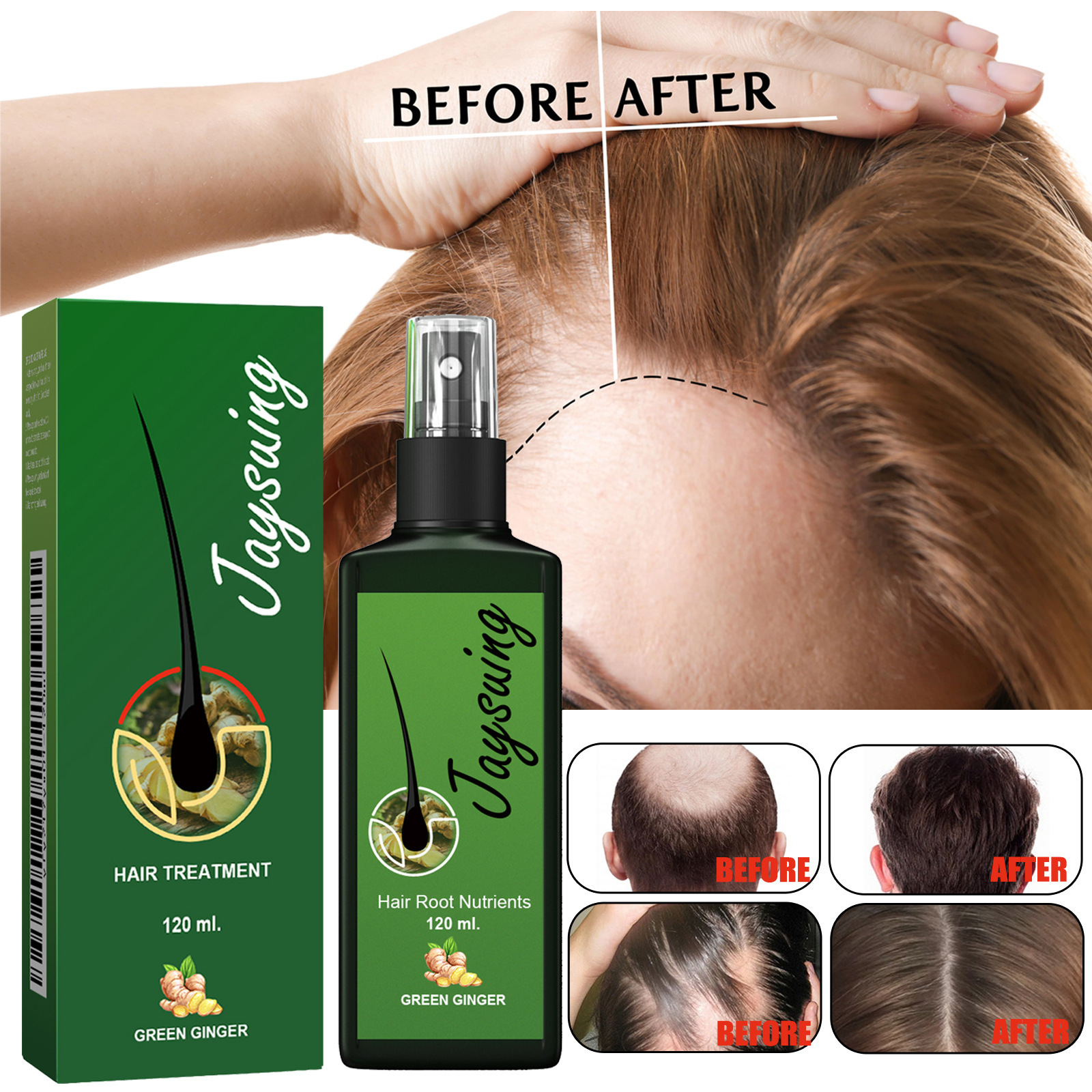 Hair Care Liquid Strengthening Nourishing Moisturizing Scalp Root Treatment Daily Hair And Scalp Massage Essence