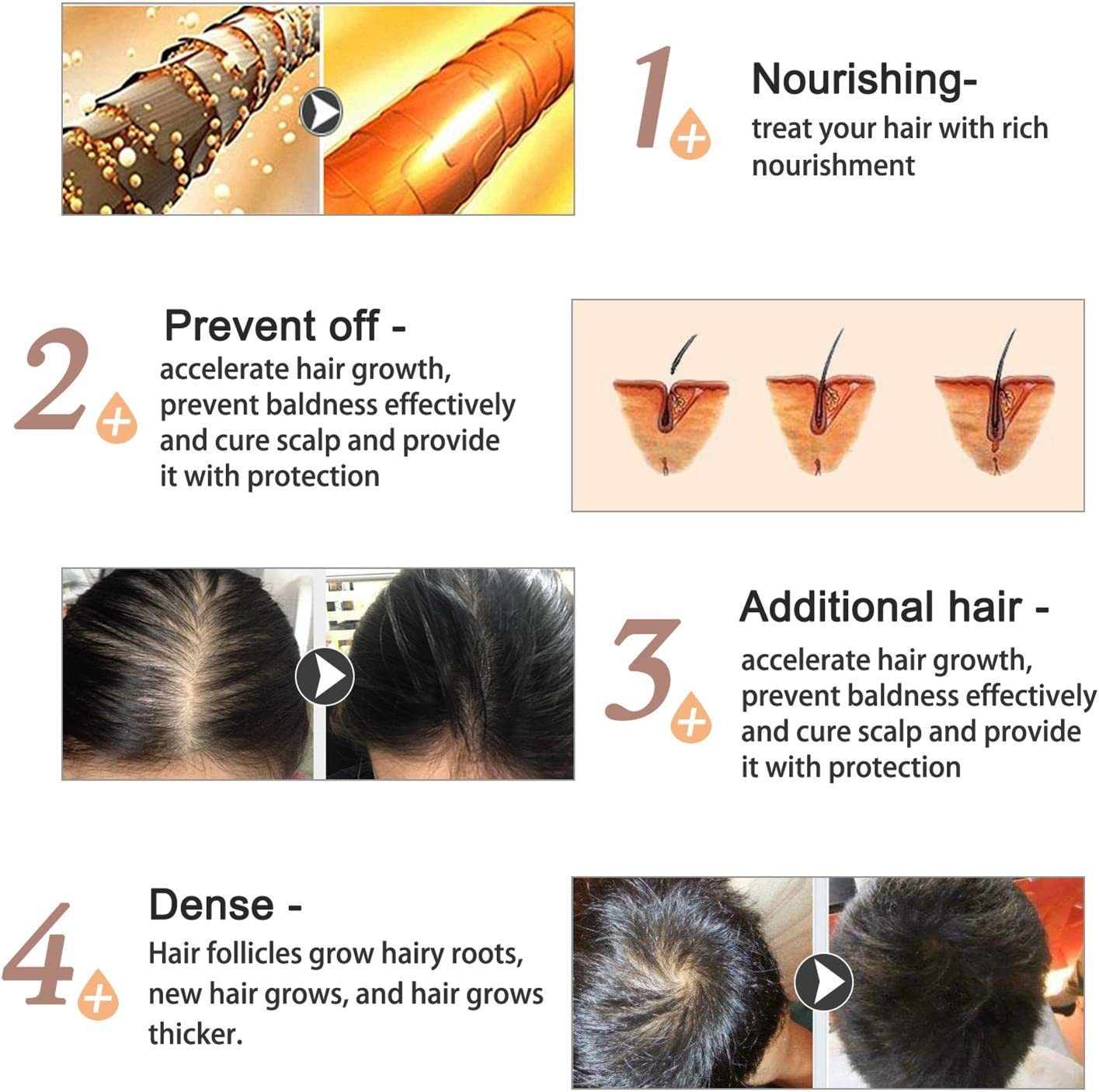 iBeaLee Anti-Hair Loss Spray Hair Growth Serum Tonic Deep Moisturize Repair Strengthen Hair Root Serum Anti-Frizz Care Scalp Nourish 20ml