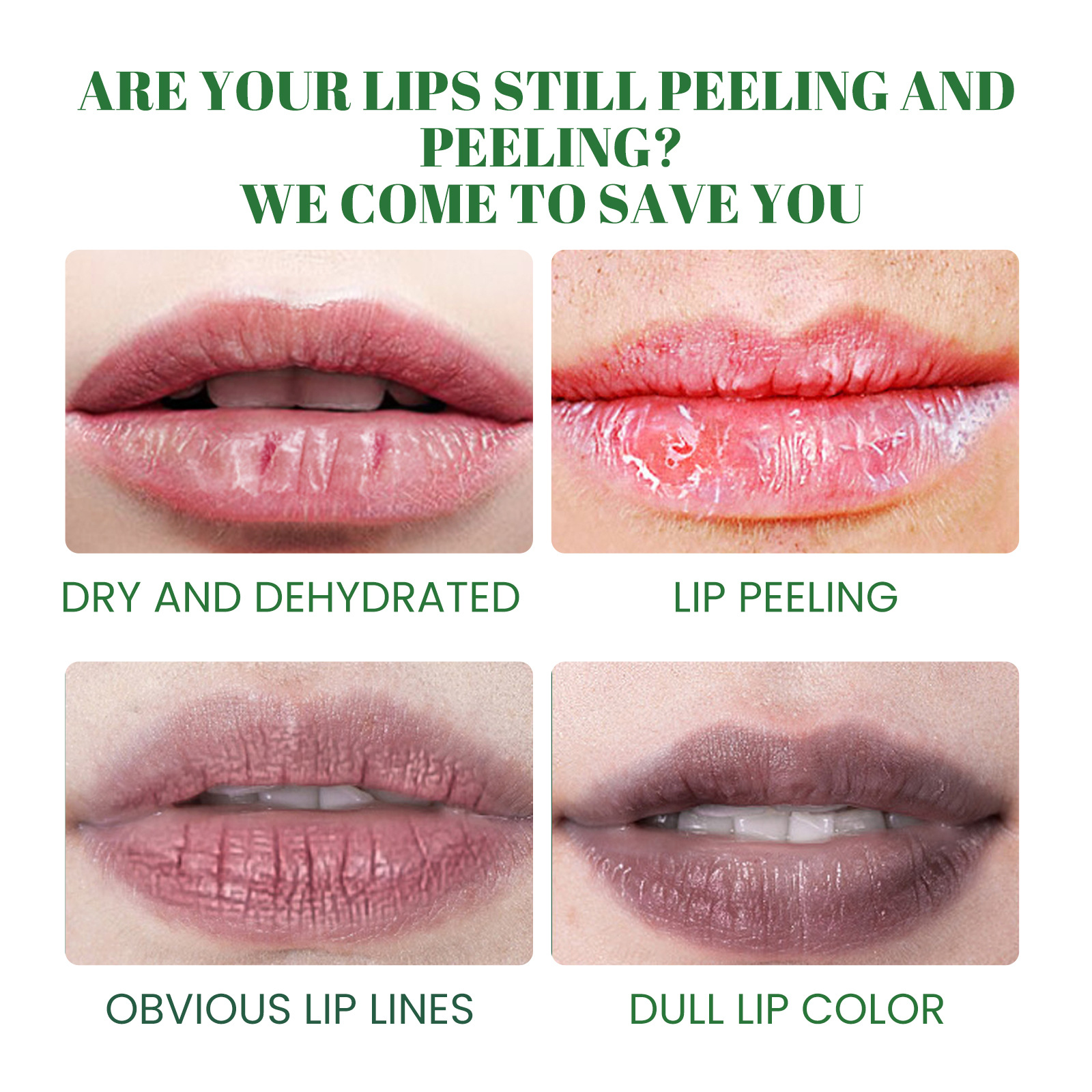 Remove Dark Lip Balm Lightening Moisturizing  Nourish Fade Lips Lines Lip Care Repair Makeup Cosmetics 3g