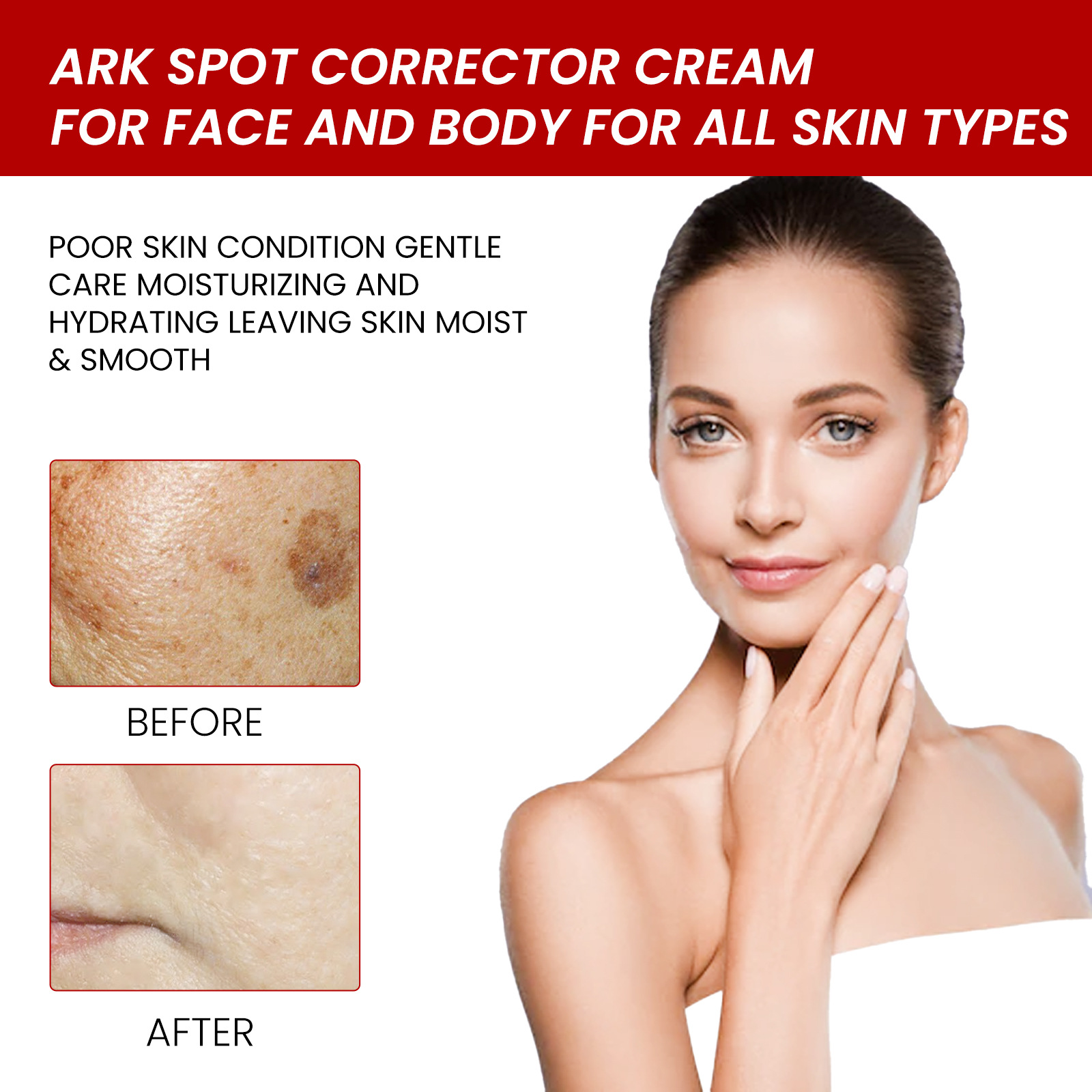 Whitening and Freckle Removing Cream Remove  Dark Spot Melanin Melasma Lighten Brighten Smooth Skin Care