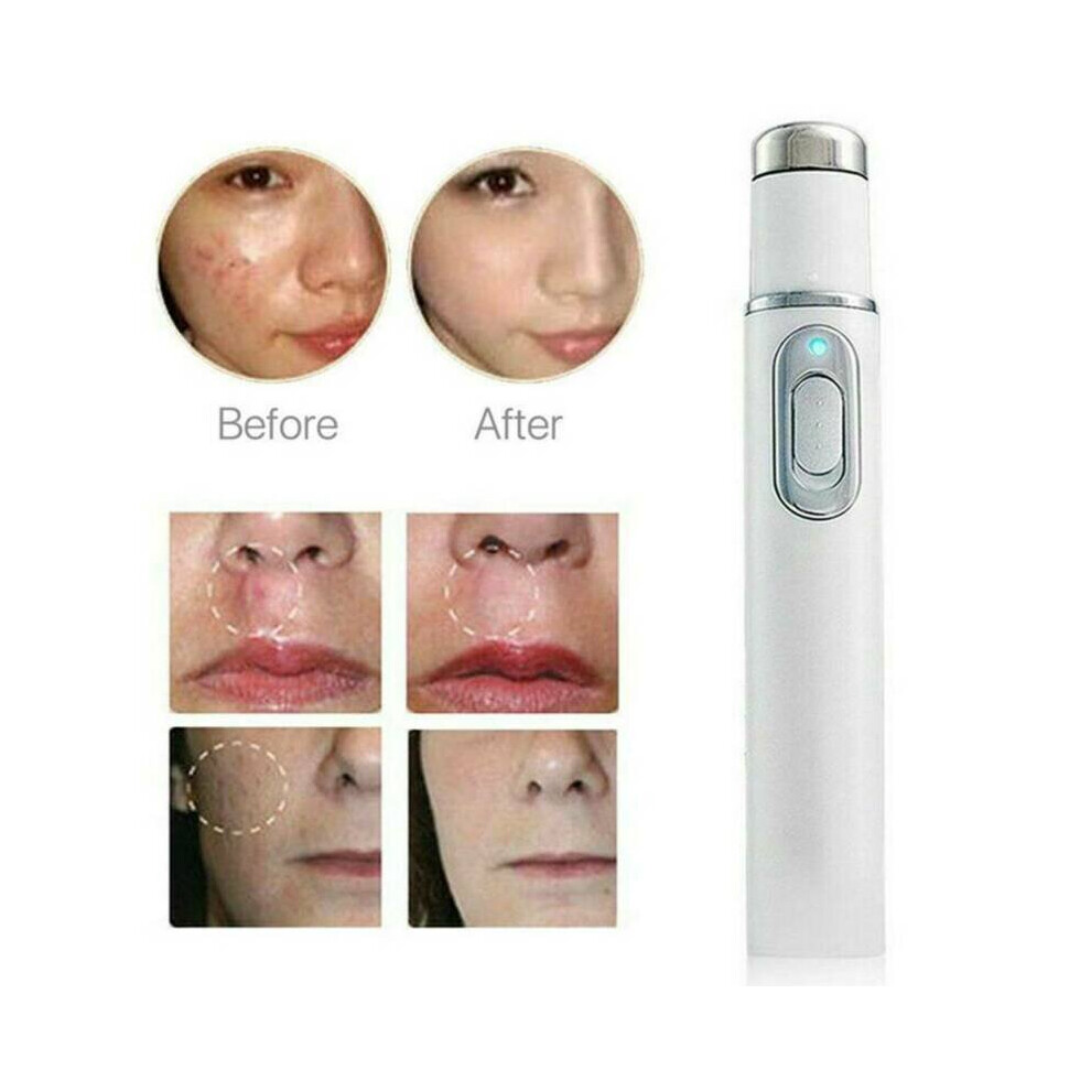 Spider Vein Eraser Blue Light Therapy Wrinkle Acne Laser Pen Scar Removal Care