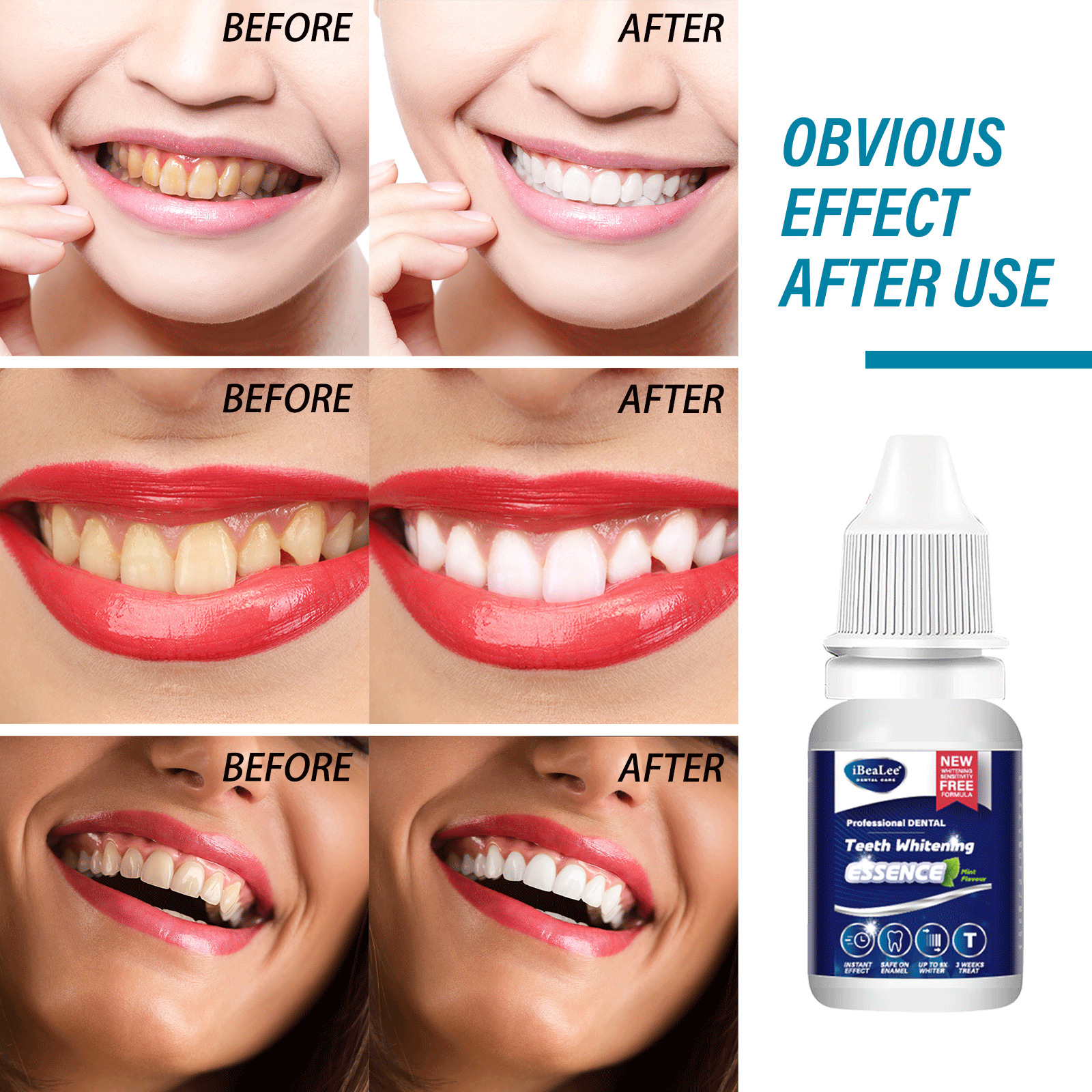 iBeaLee Teeth Whitening Essences Extra Strong White Hygiene Tooth Whitener Stain Removal