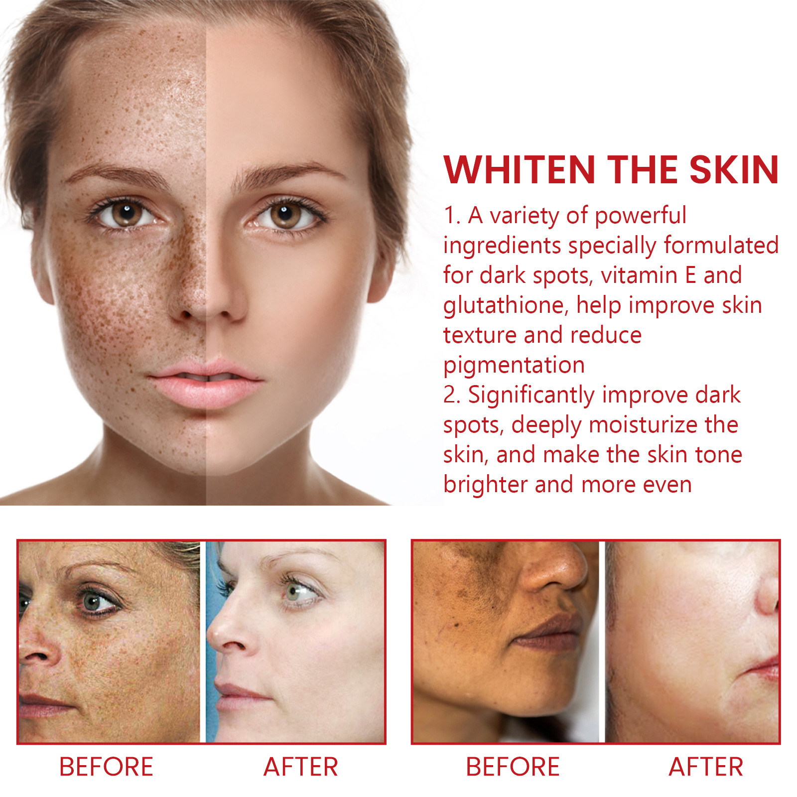 Dark Spot Repair Cream Moisturizer Anti-dark Spot Fine Lines Pigment Remover Cream Whitening Brighten Moisturizing