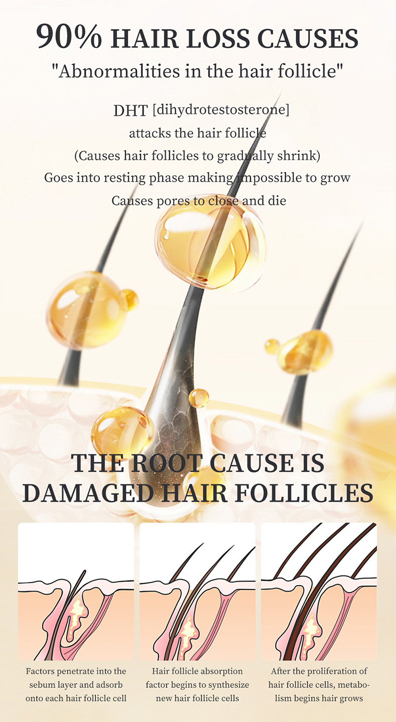 (1 PC) Dense Hair Growth Serum Hair Care Hair Growth Products Growing Hair Oil Hair Loss Care Liquid Beauty Hair Scalp Treatment Effective Baldness Repair Treatment