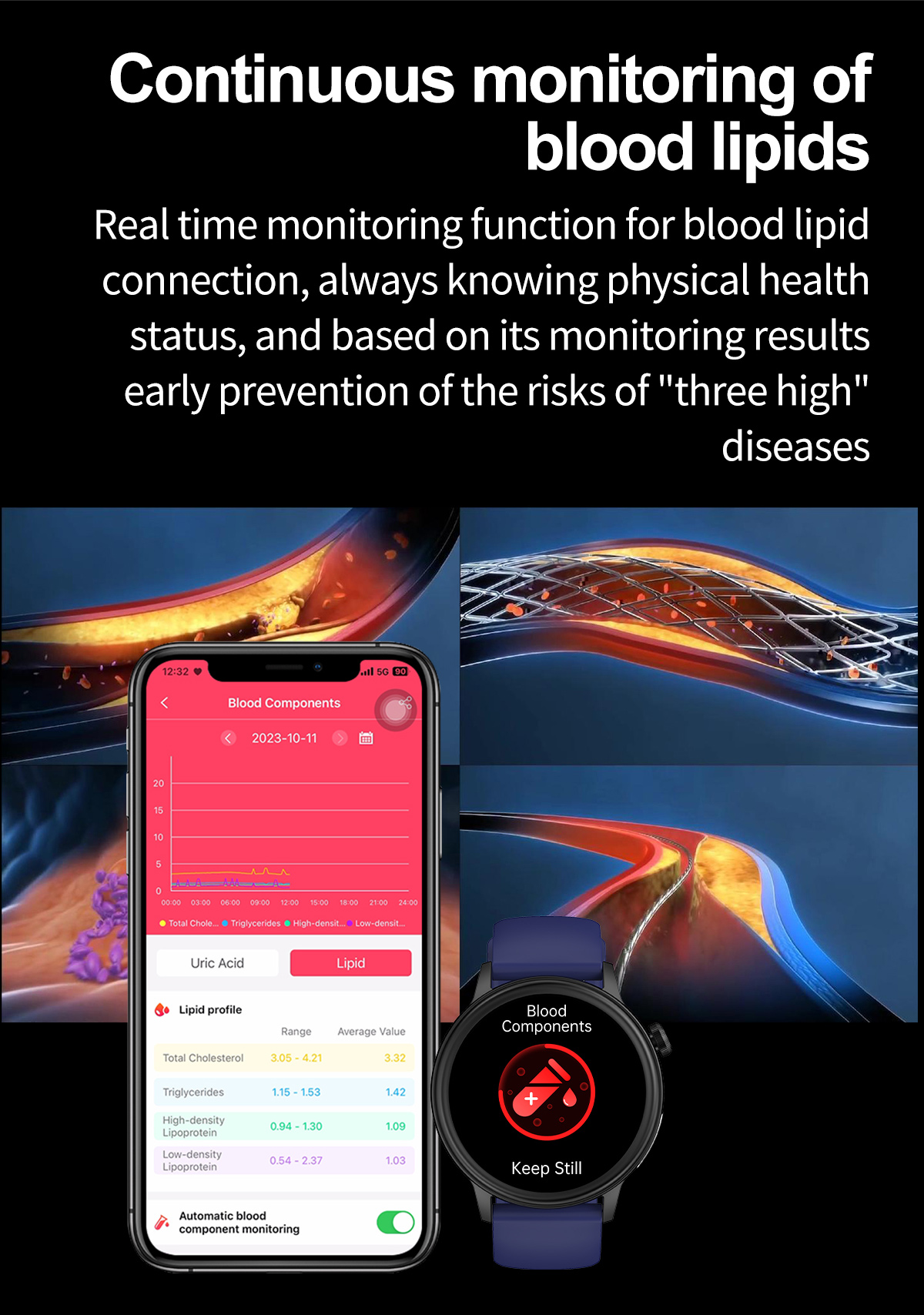 (Black) Women Smart Watch Blood Sugar Health ECG Blood Pressure Blood Lipid Blood Oxygen Monitoring Bluetooth Call Watch