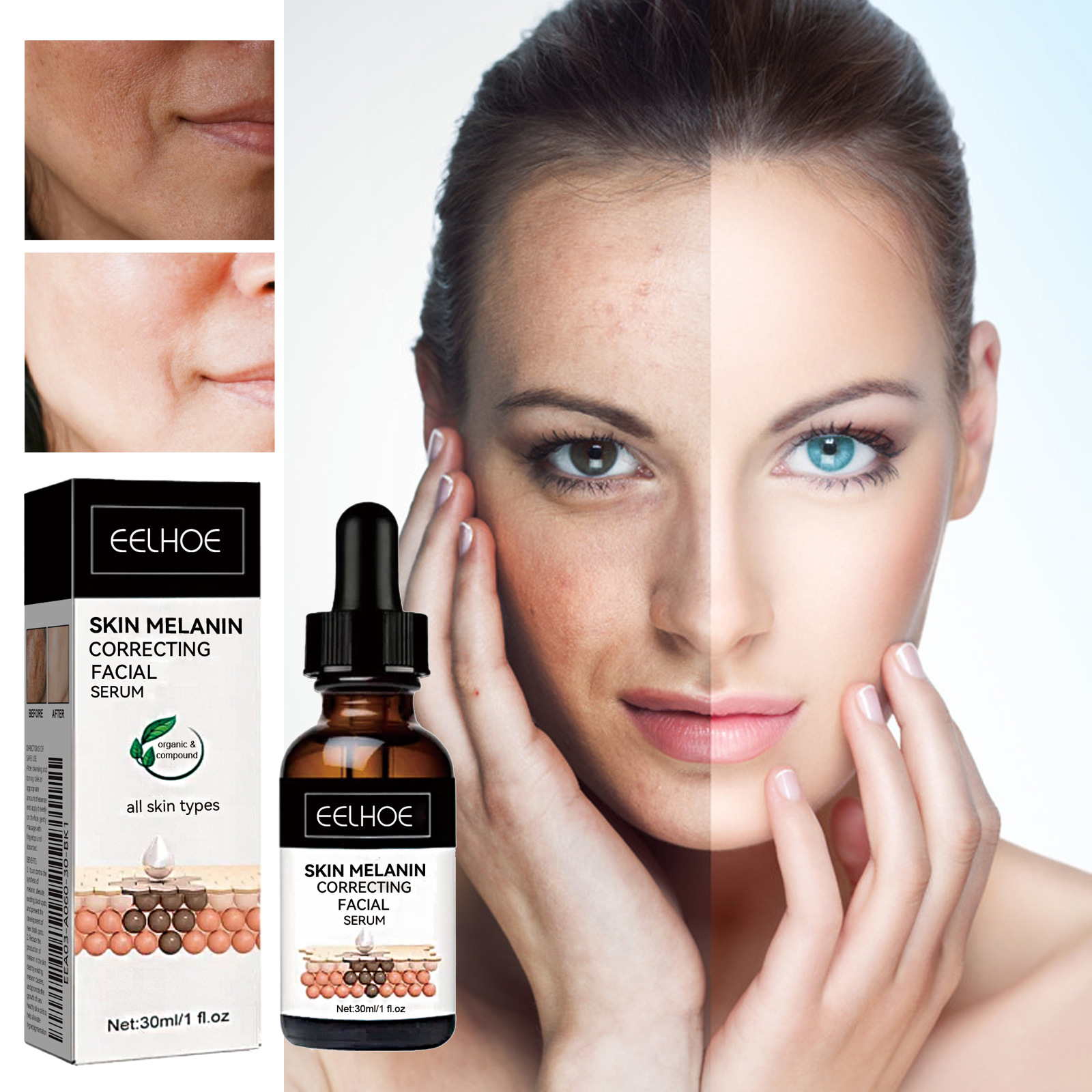 EELHOE Skin Melanin Correcting Serum Fade Dark Spots Anti Freckle Melasma Remover Dull Skin Nourish Lighten Pigment Blemish Glow Vitamin C Face Essence.