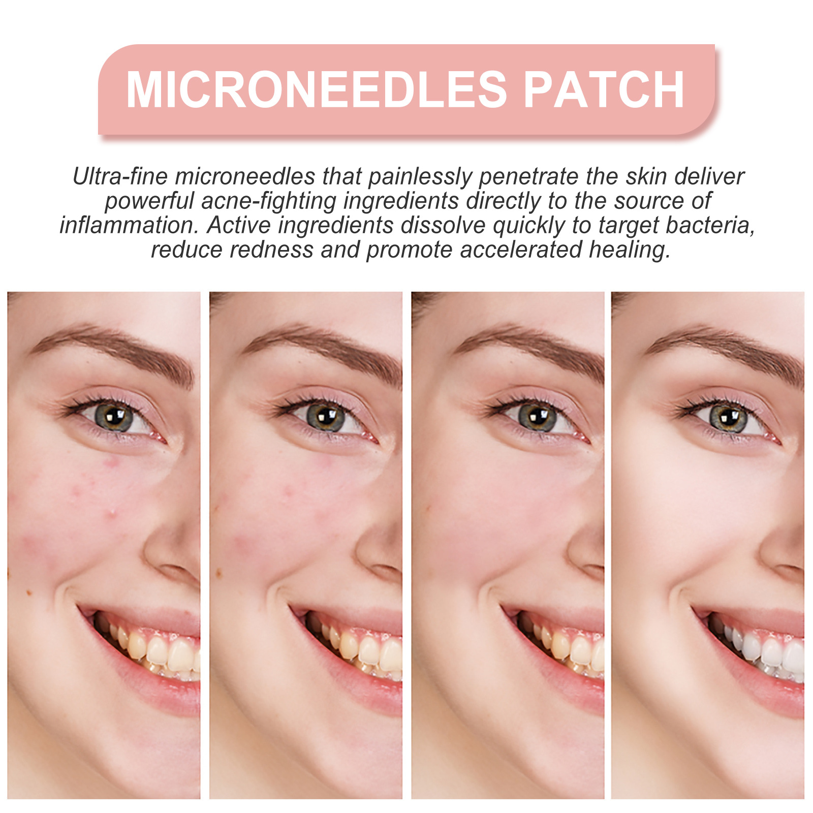 (1 PC) Face Patches For Pimples Microneedles Drying Patch Blemish Covering Repair Stickers Invisible Anti Acne Spots Marks Concealer Care Absorbing All Day