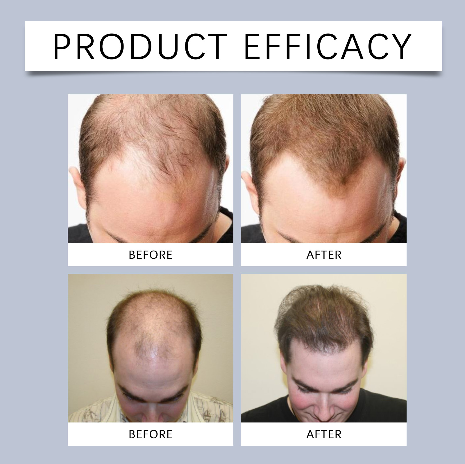 Men Hair Care Roller Ball Moisturizing Refreshing Mild Nourishing Smooth Portable For Hair Styling Daily Use