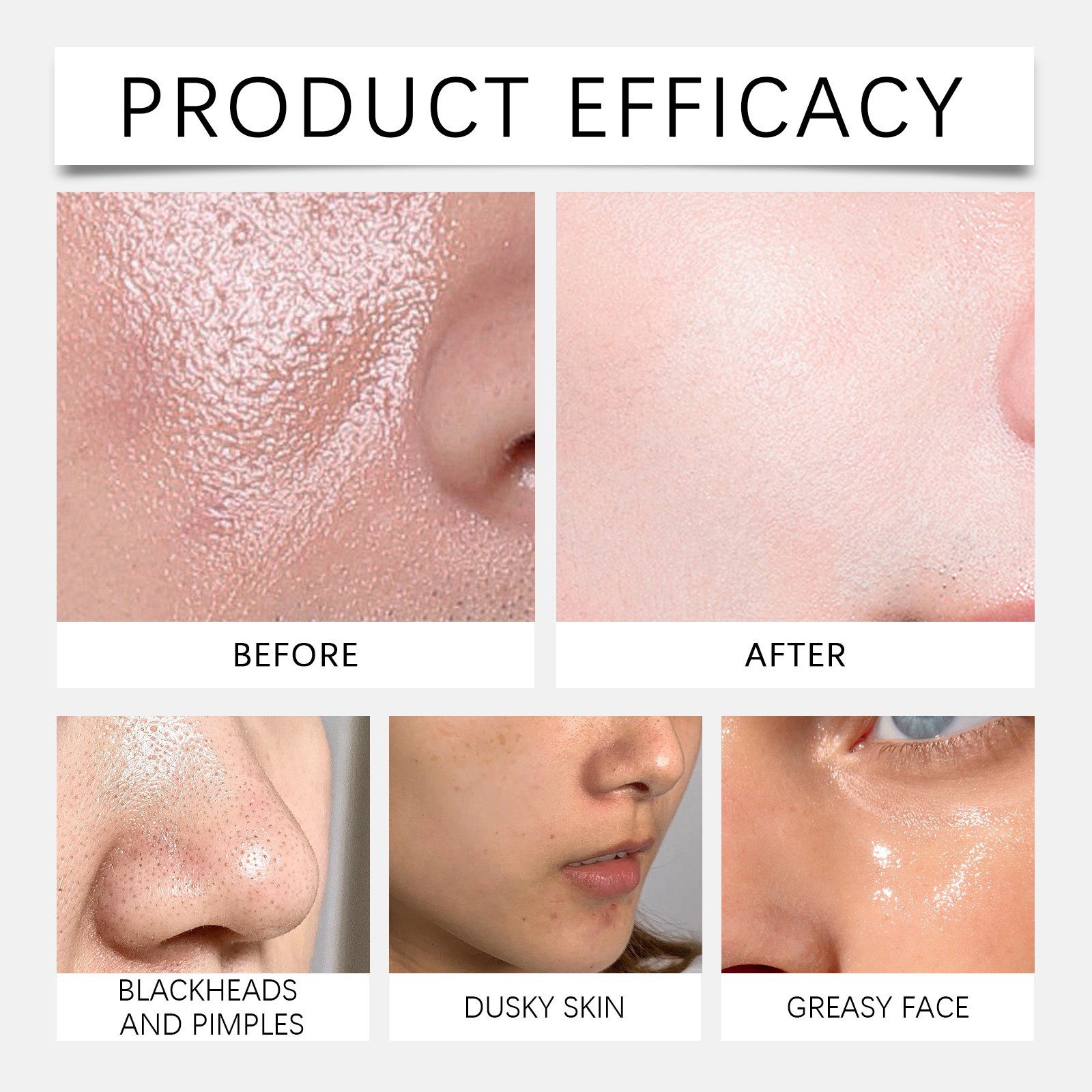 Renewing Cream Mild Ingredients Nourish Facial Skin Moist Hydrate Fresh Smooth Daily Massage Skincare Lotion