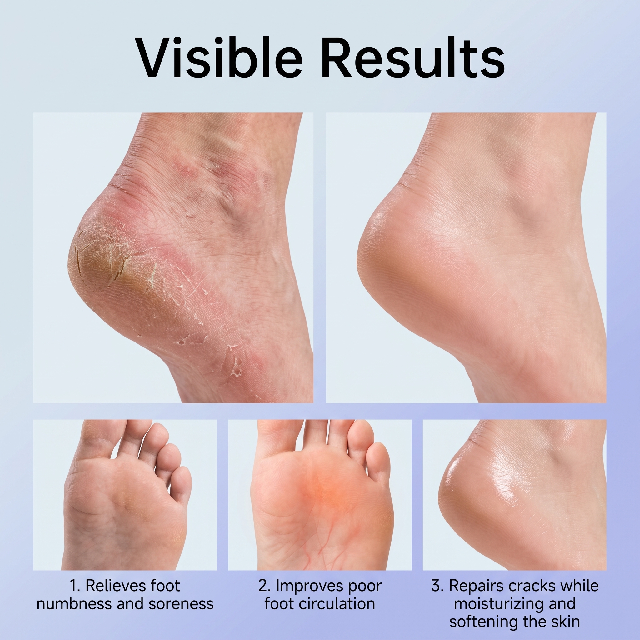 Foot Care Spray Moisturize Foot Instep Skin Hydrate Comfort Dry Care Daily Maintain Spray