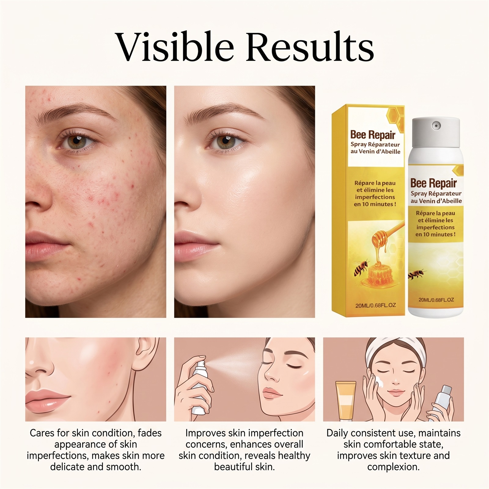 Bee Venom Skin Comfort Spray Moisturizing Care Body Skin Refreshing Delicate Smooth Daily Portable Nursing