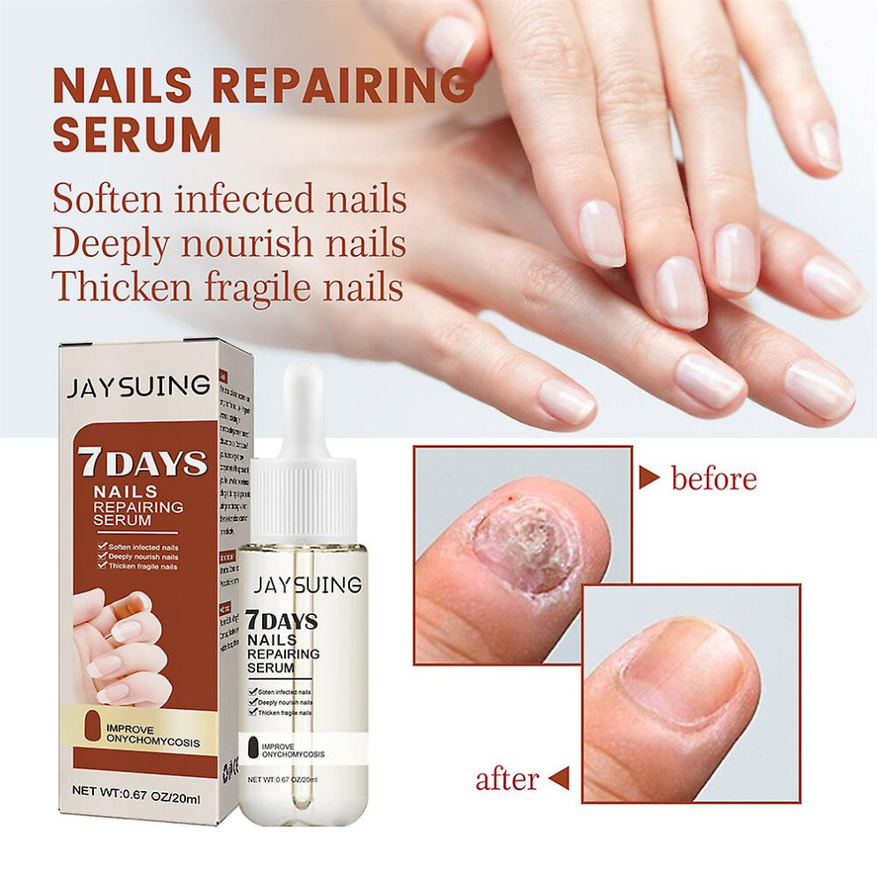 7 Days Nail Growth And Strengthening Serum, Nail Growth And Strength Serum