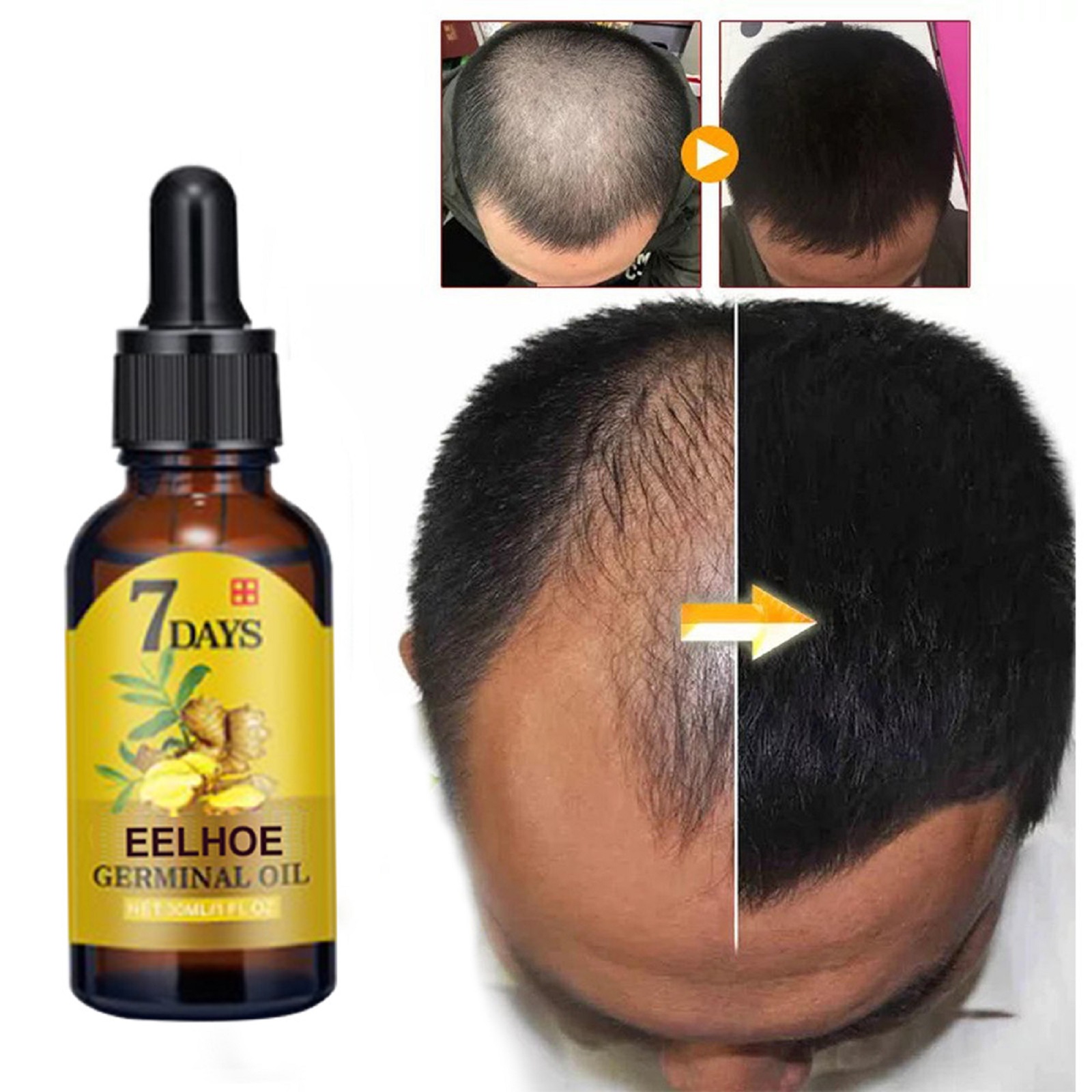 Ginger Hair Care Liquid Nourishing Scalp Strengthening Roots Anti Hair Loss For Daily Hair Treatment 40ml