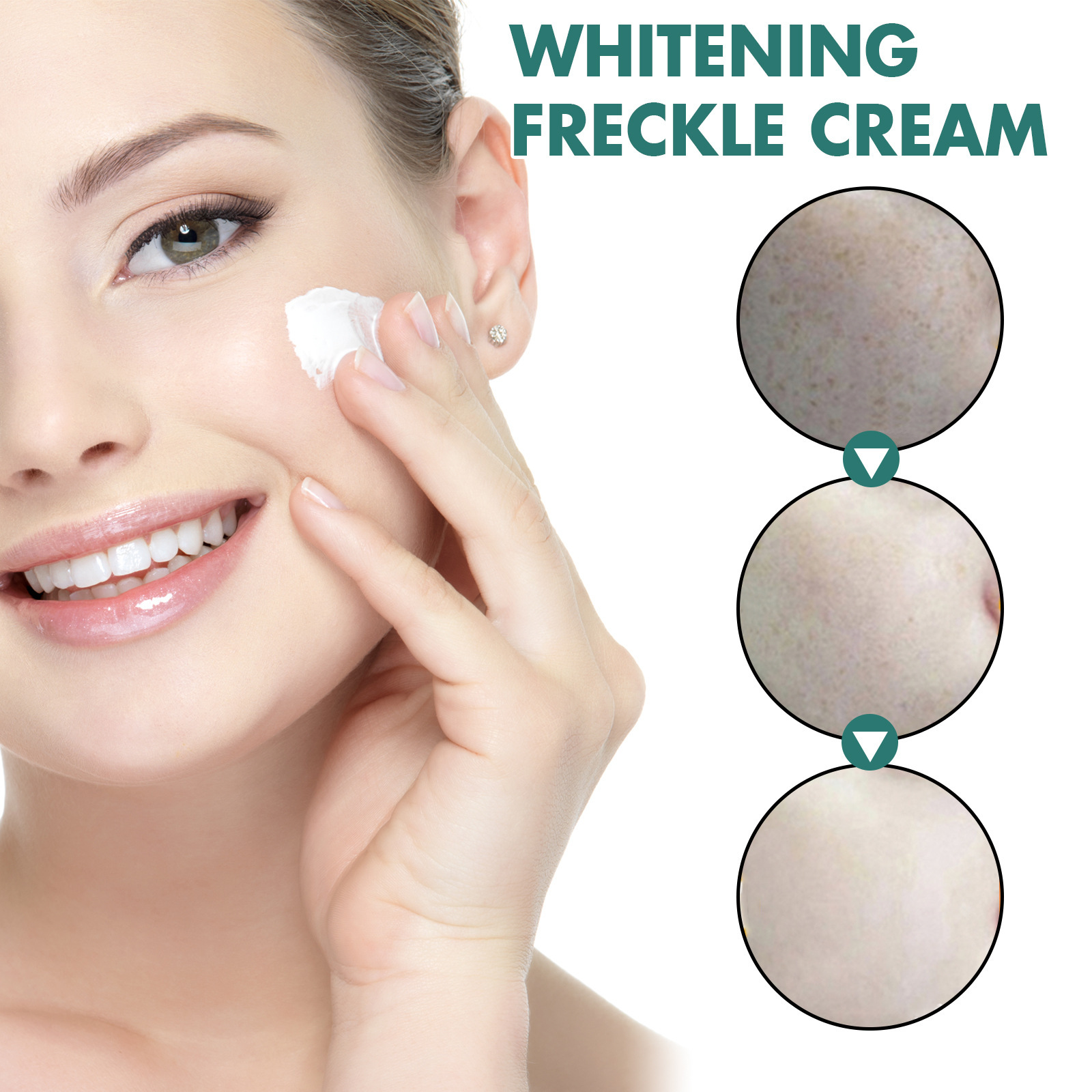 Niacinamide Melasma Brightening Cream Reduce Melanin Brighten Cream Lighten Dark Skin Chloasma Serum Fade Fine Lines Face Care Cream 30g