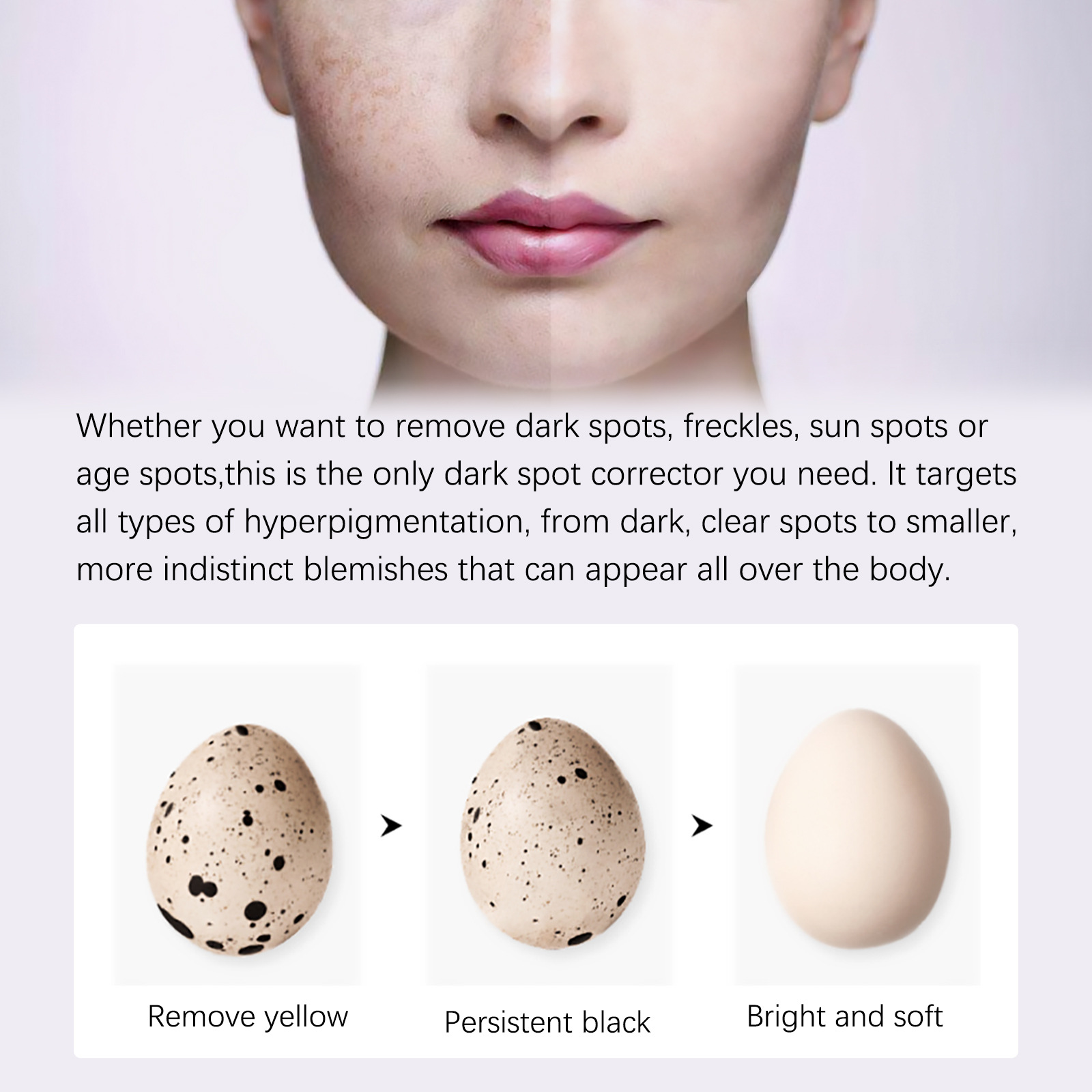 Whitening Freckles Cream Face Remove Melasma Dark Spots Lighten Melanin Melasma Remover Moisturizing Brighten Skin Care 30ml